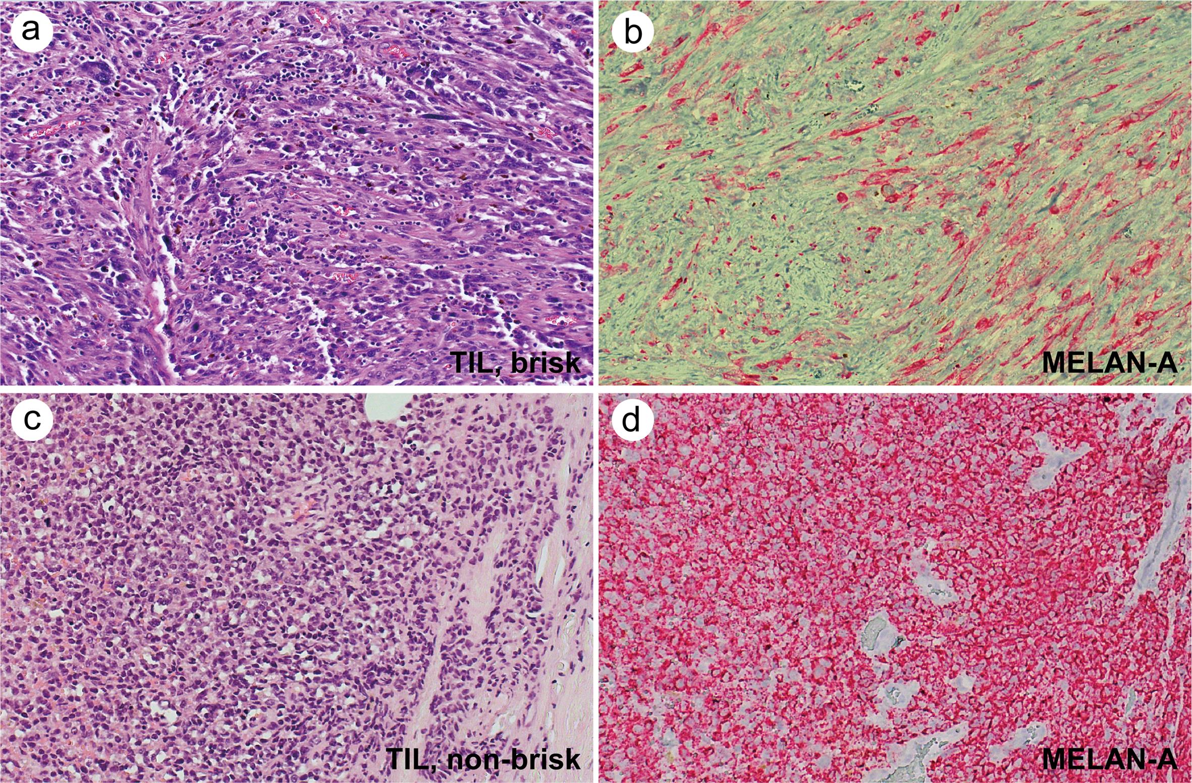 Immunohistochemistry of Immunohistochemistry.