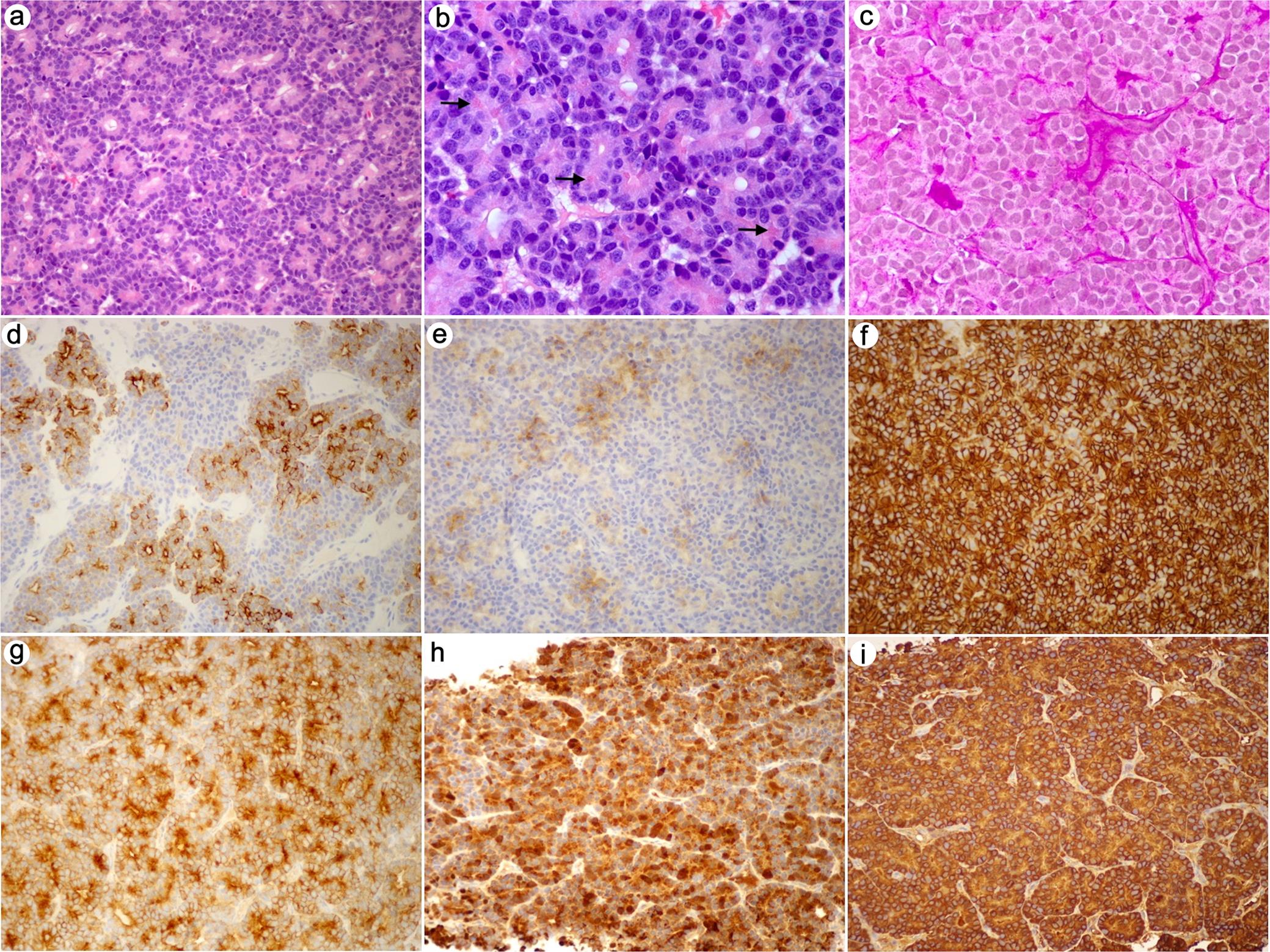 Histology and staining of the specimen.