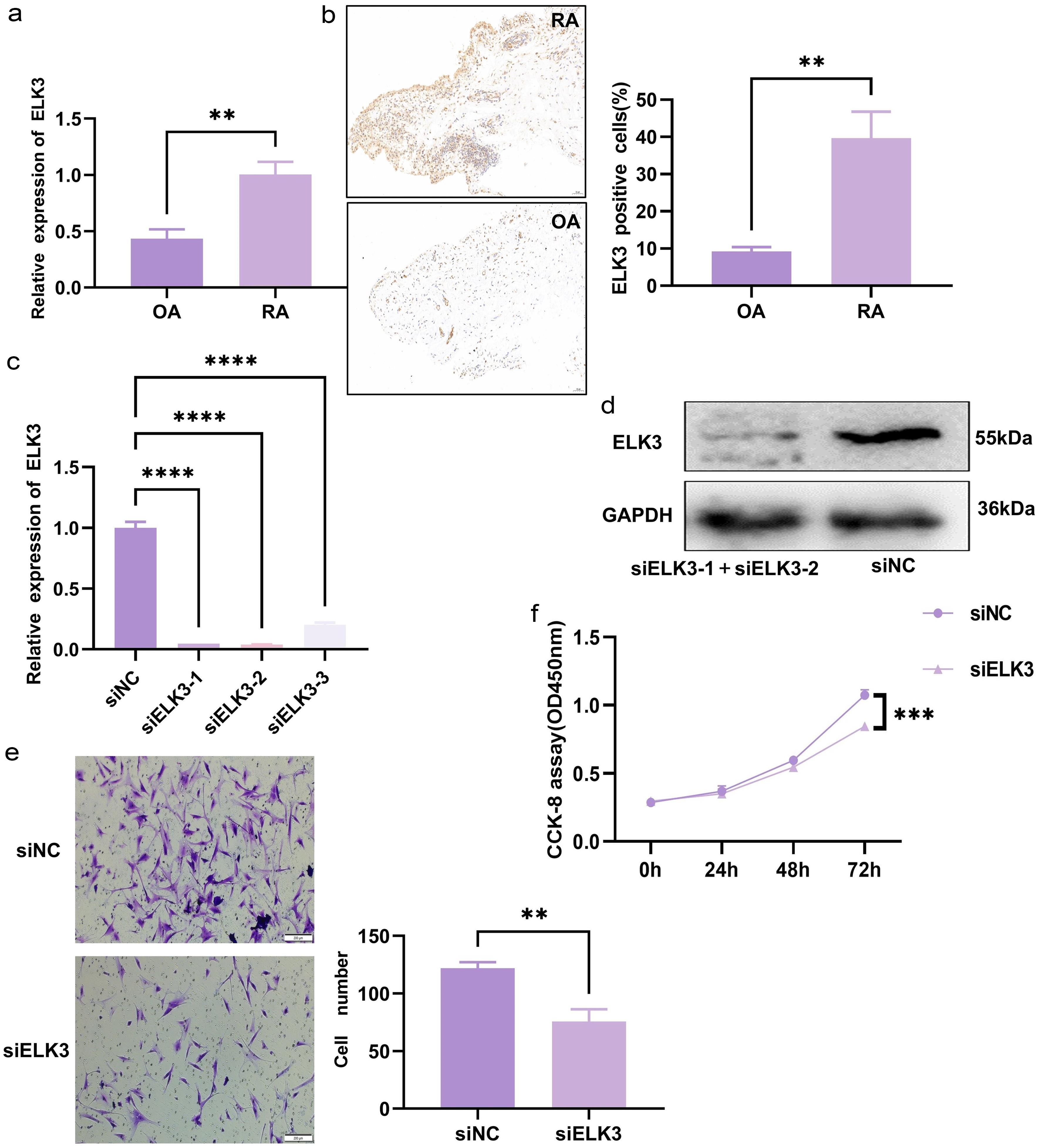 Effect of ELK3 on the biological activity of rheumatoid arthritis (RA) fibroblast-like synoviocytes (FLS).