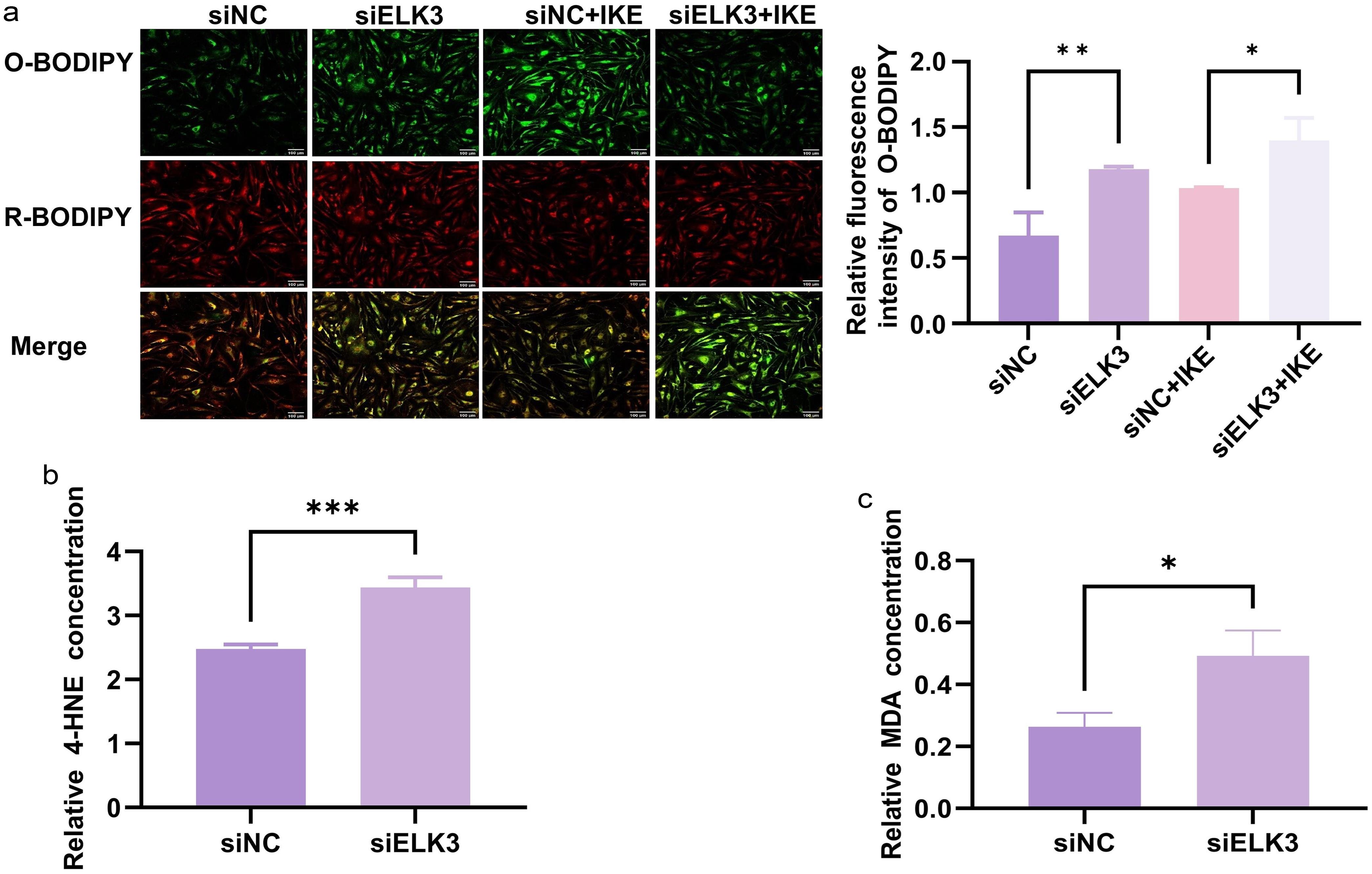 Effect of ELK3 on lipid peroxidation in rheumatoid arthritis (RA) fibroblast-like synoviocytes (FLS).