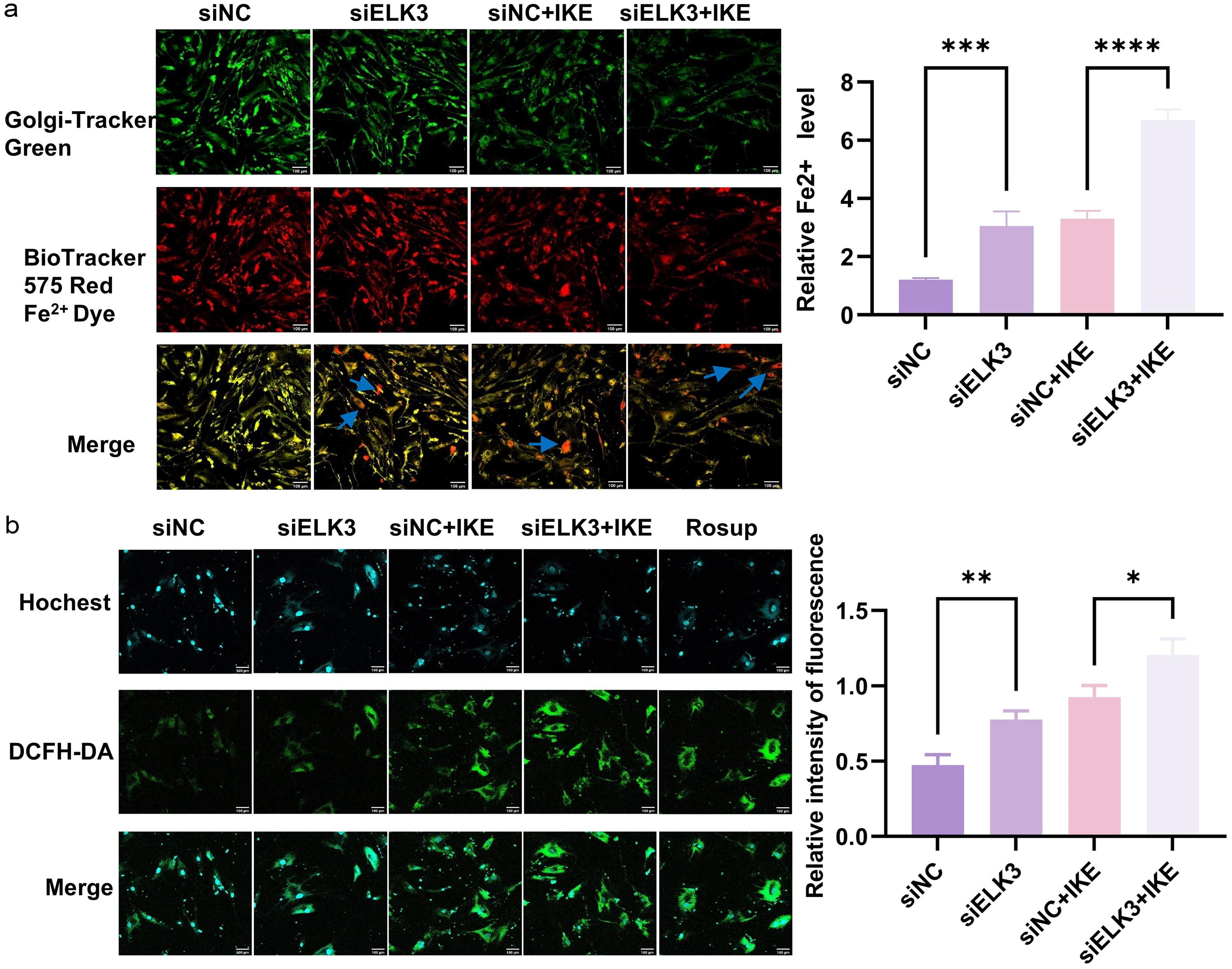 Effect of ELK3 on Fe<sup>2+</sup> and ROS levels in rheumatoid arthritis (RA) fibroblast-like synoviocytes (FLS).