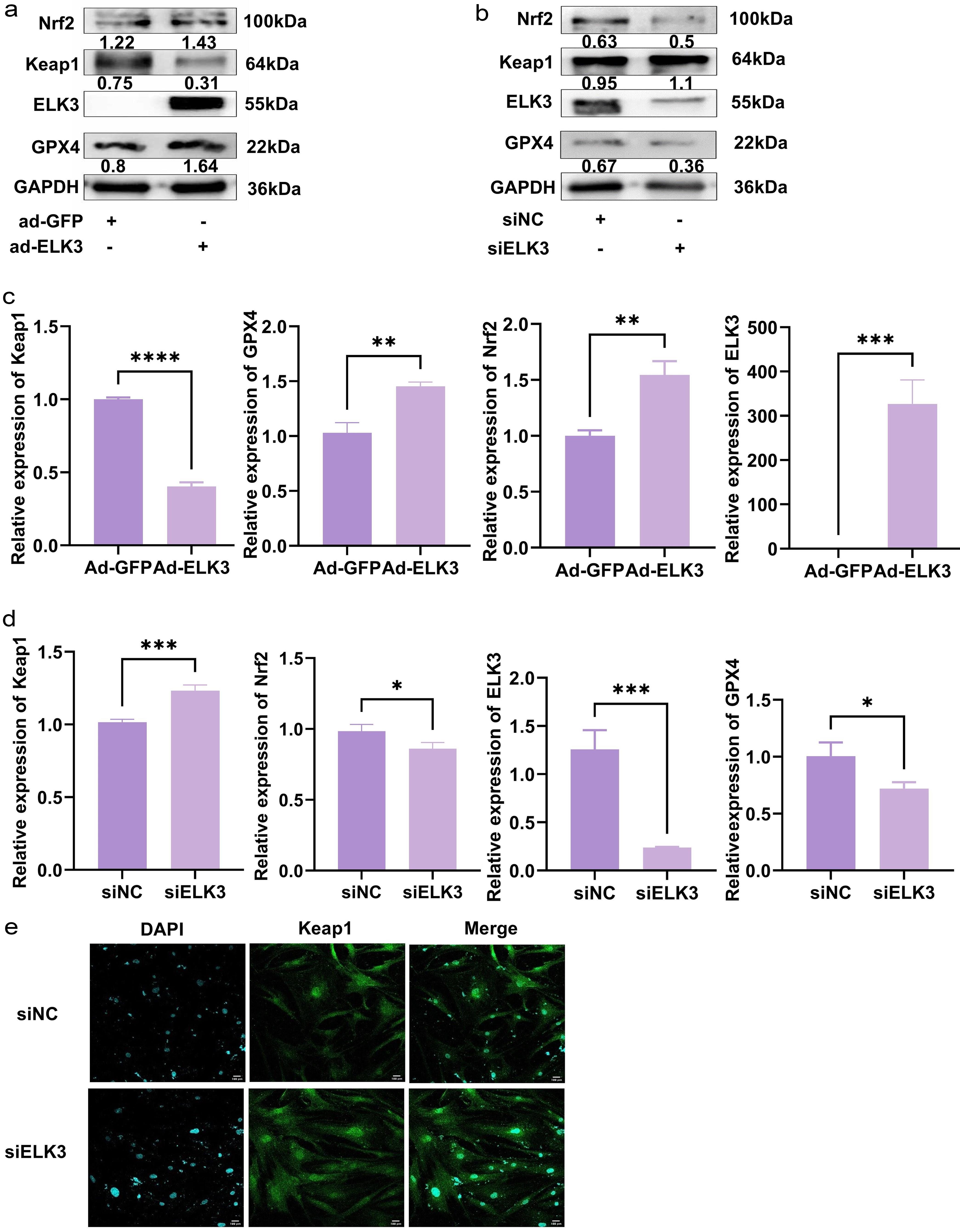 ELK3 regulates ferroptosis-related markers.