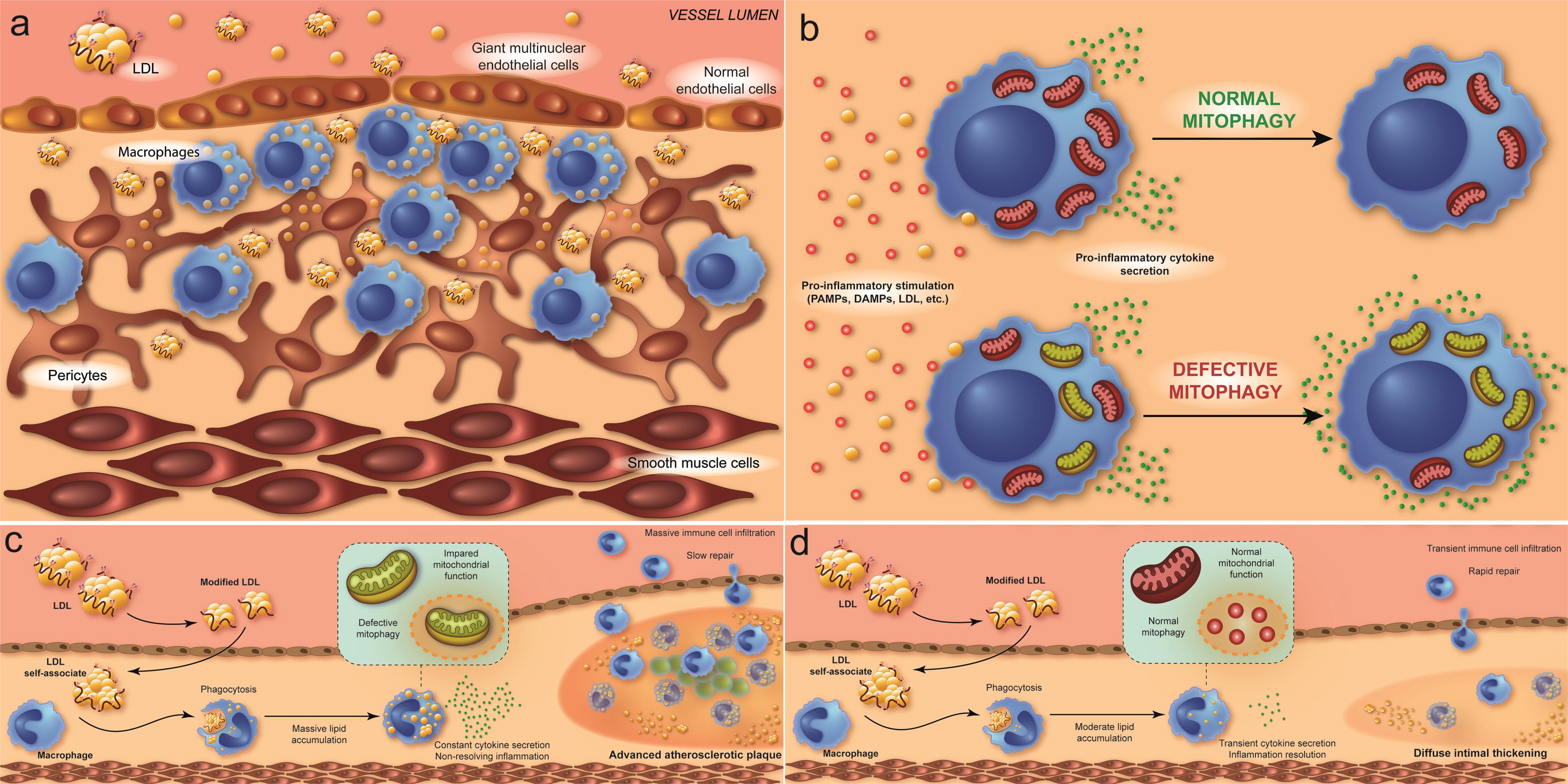 Role of Mitochondria in the Chronification of Inflammation: Focus on ...