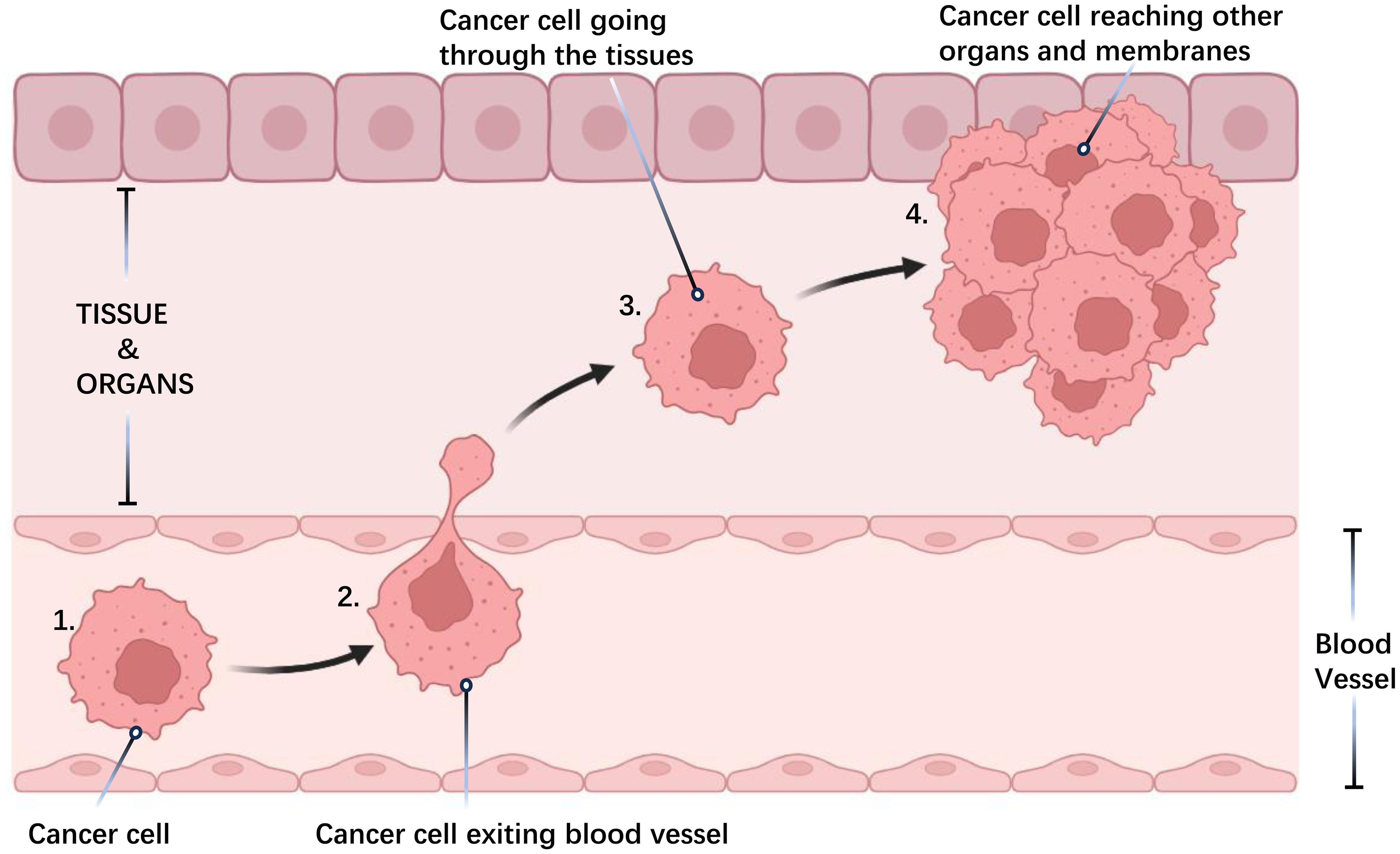 Cancer cells enter the metastasis site from the blood vessel.