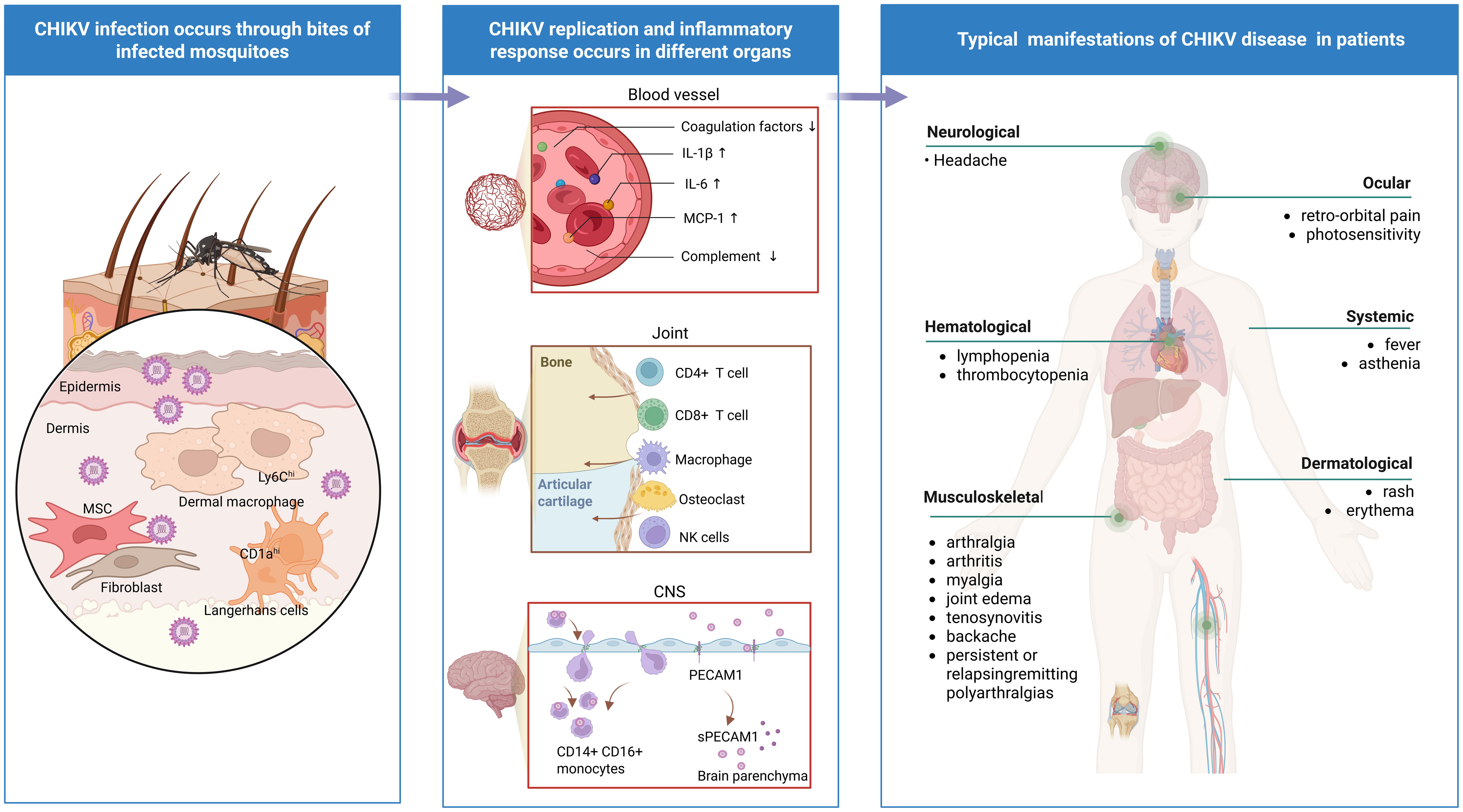 Pathogenesis and systemic manifestations of Chikungunya fever.