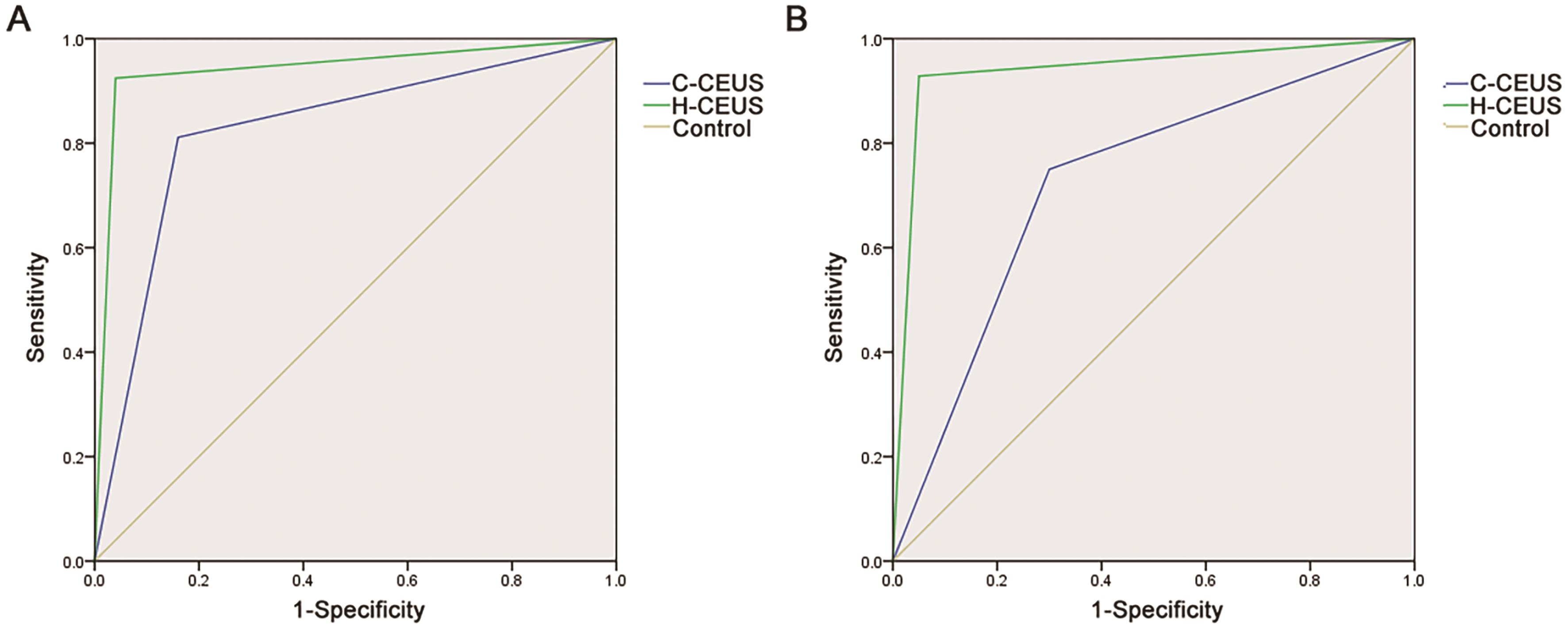 ROC analysis of C-CEUS and H-CEUS for the diagnosis of malignant FLL.