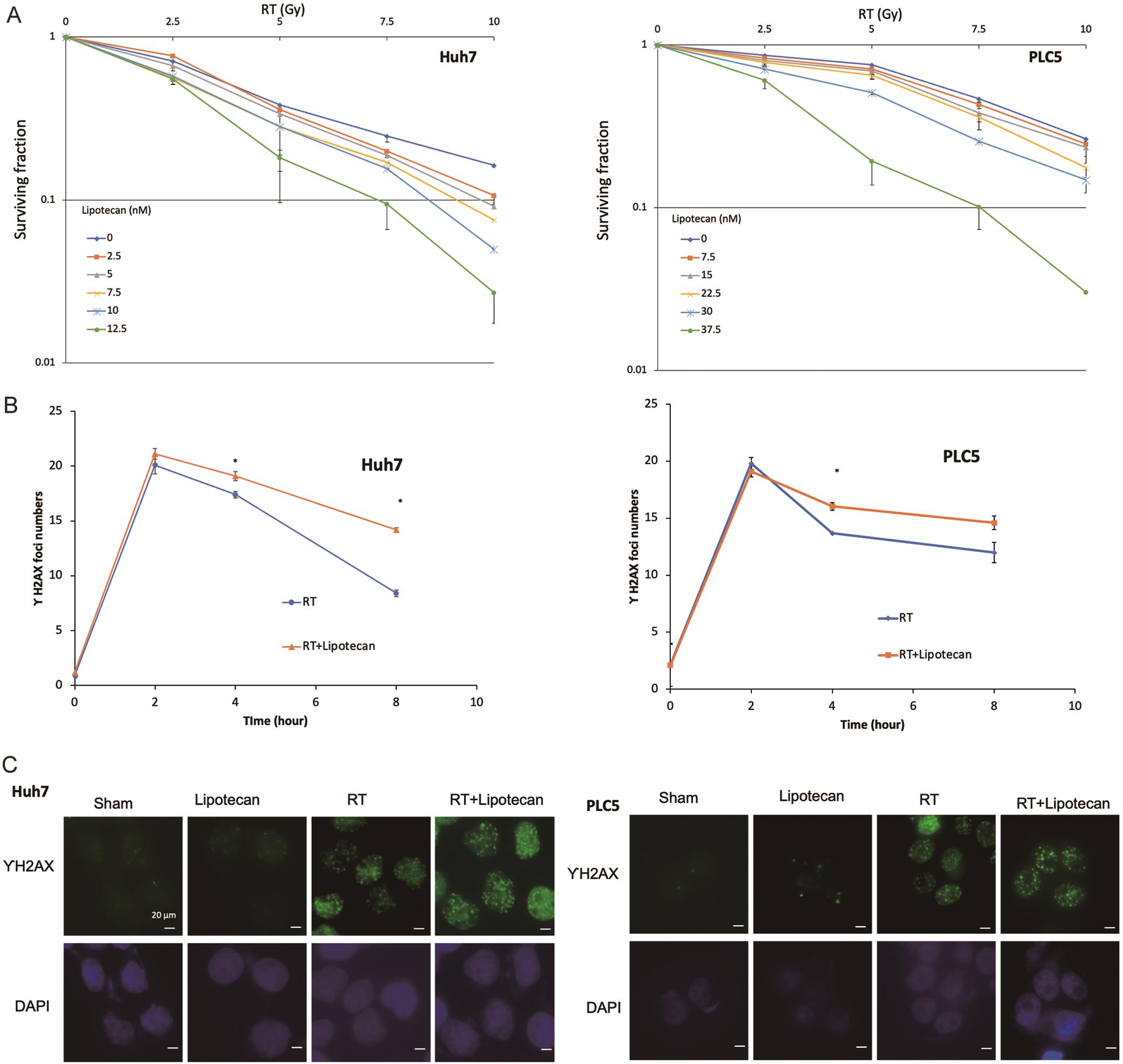 Radiosensitizing effect of topoisomerase 1 inhibitor (TOP1i, Lipotecan) on hepatocellular carcinoma (HCC) cells.