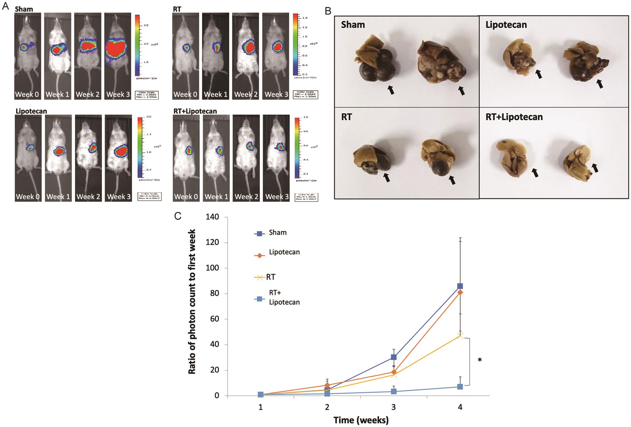 Radiotherapy (RT) combined with topoisomerase 1 inhibitor (TOP1, Lipotecan) inhibited orthotopic liver xenograft tumor models in severe combined immunodeficient mouse.