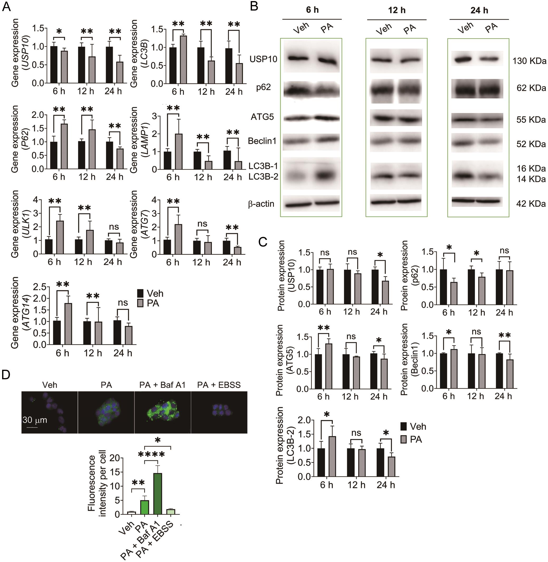 PA affected autophagic activity and expression of USP10 of HepG2 cells.