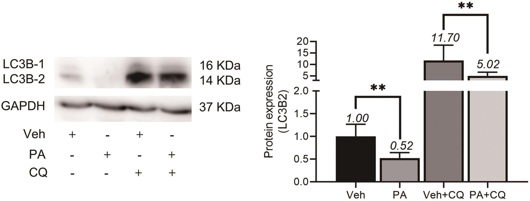 Palmitic acid inhibited autophagic flux of HepG2 cells.