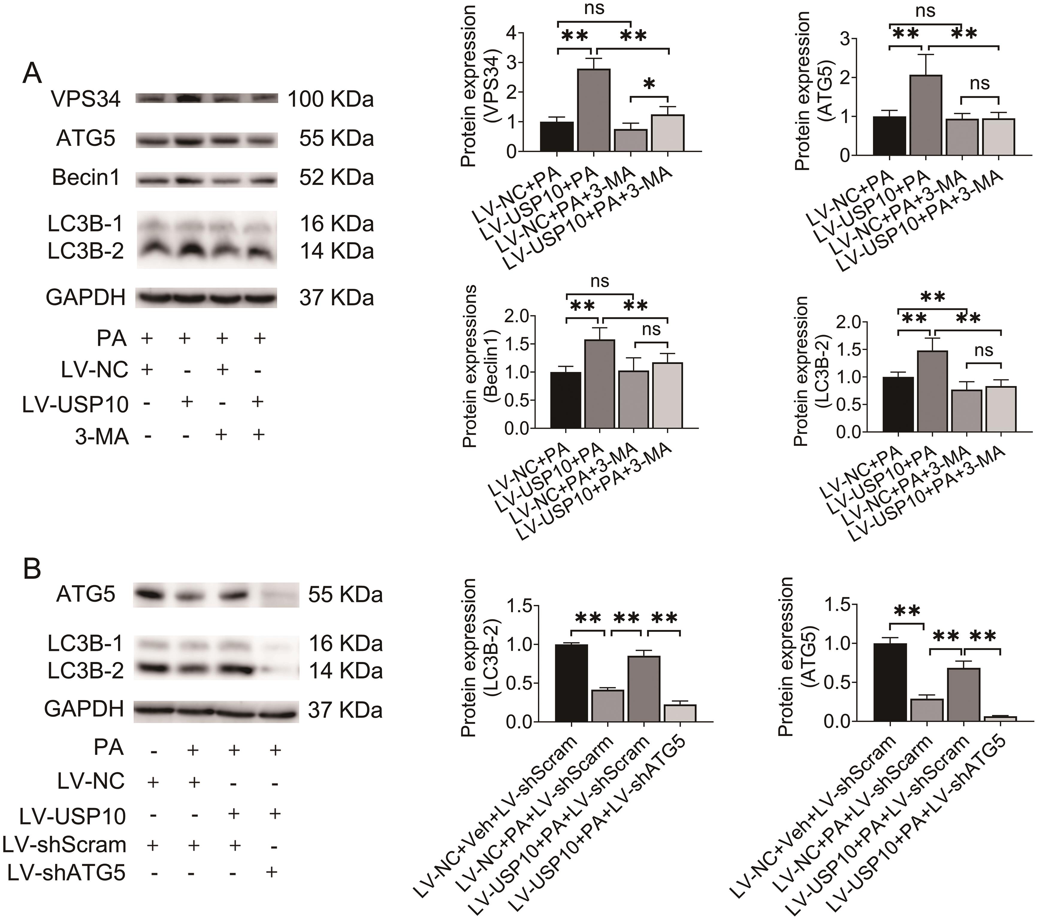 USP10 restored autophagic activity of HepG2 cells through the classic autophagy pathway.