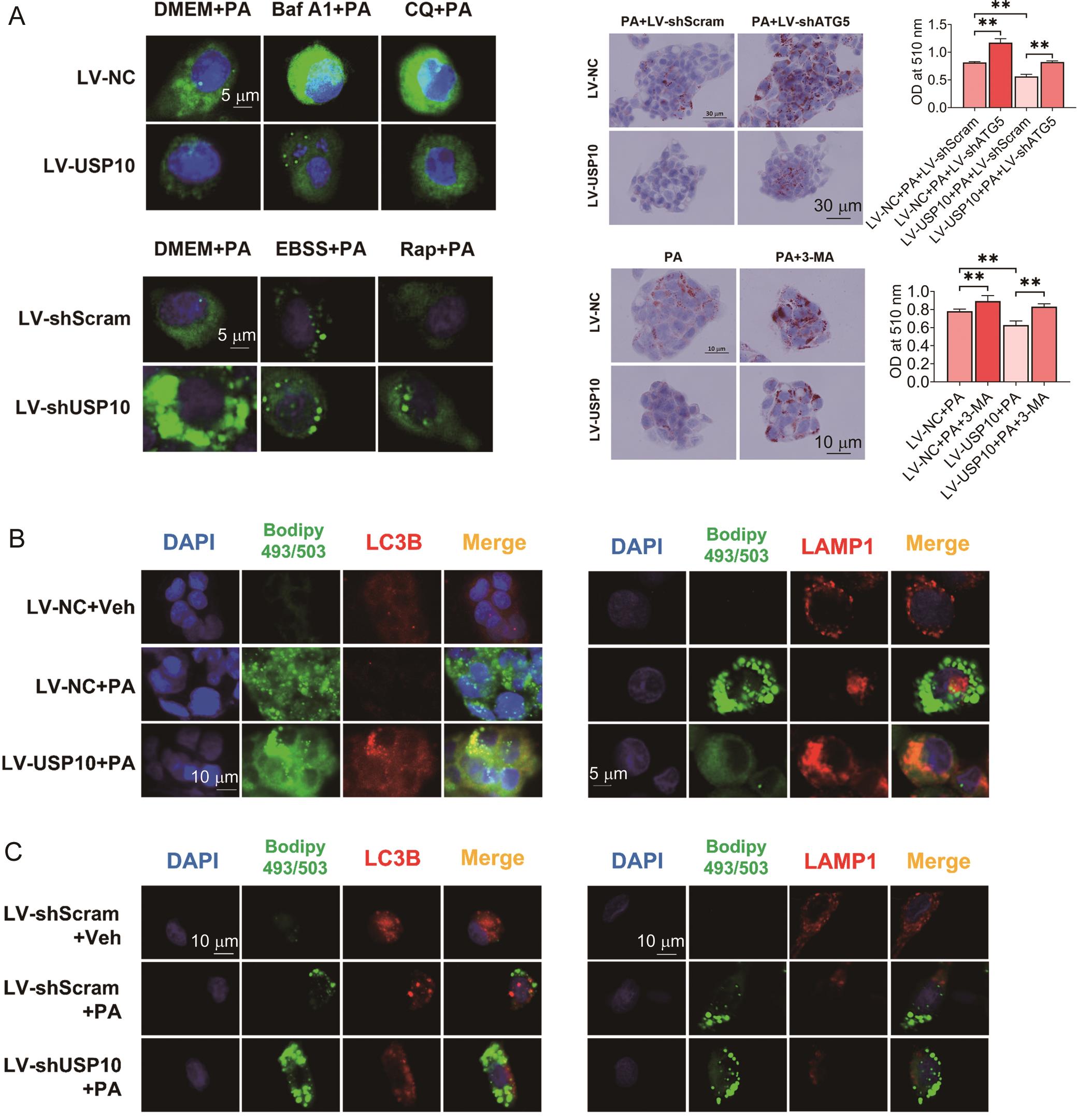 USP10 promoted lipid-targeted autophagy of HepG2 cells.