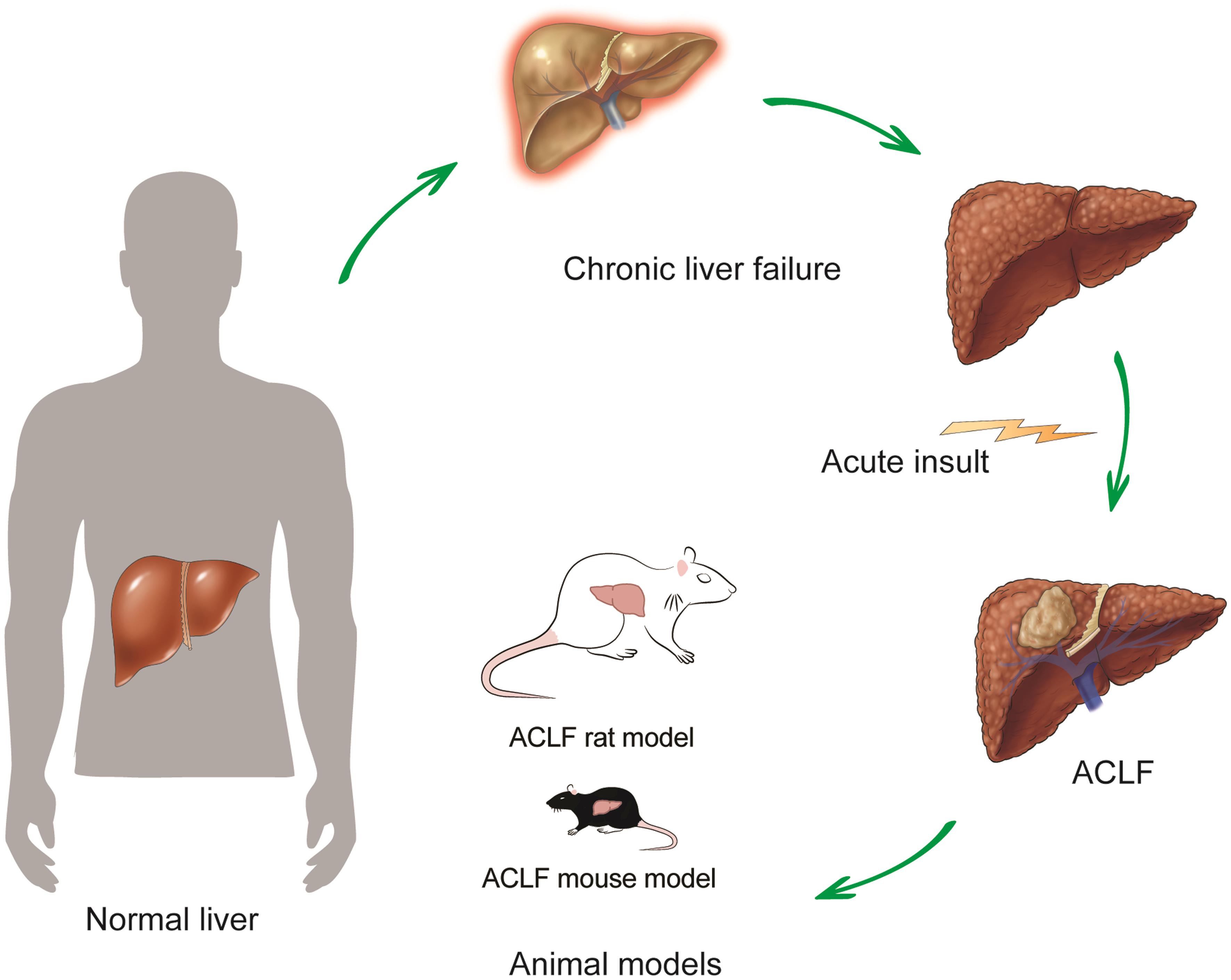 Prospect of Animal Models for Acuteonchronic Liver Failure A Minireview