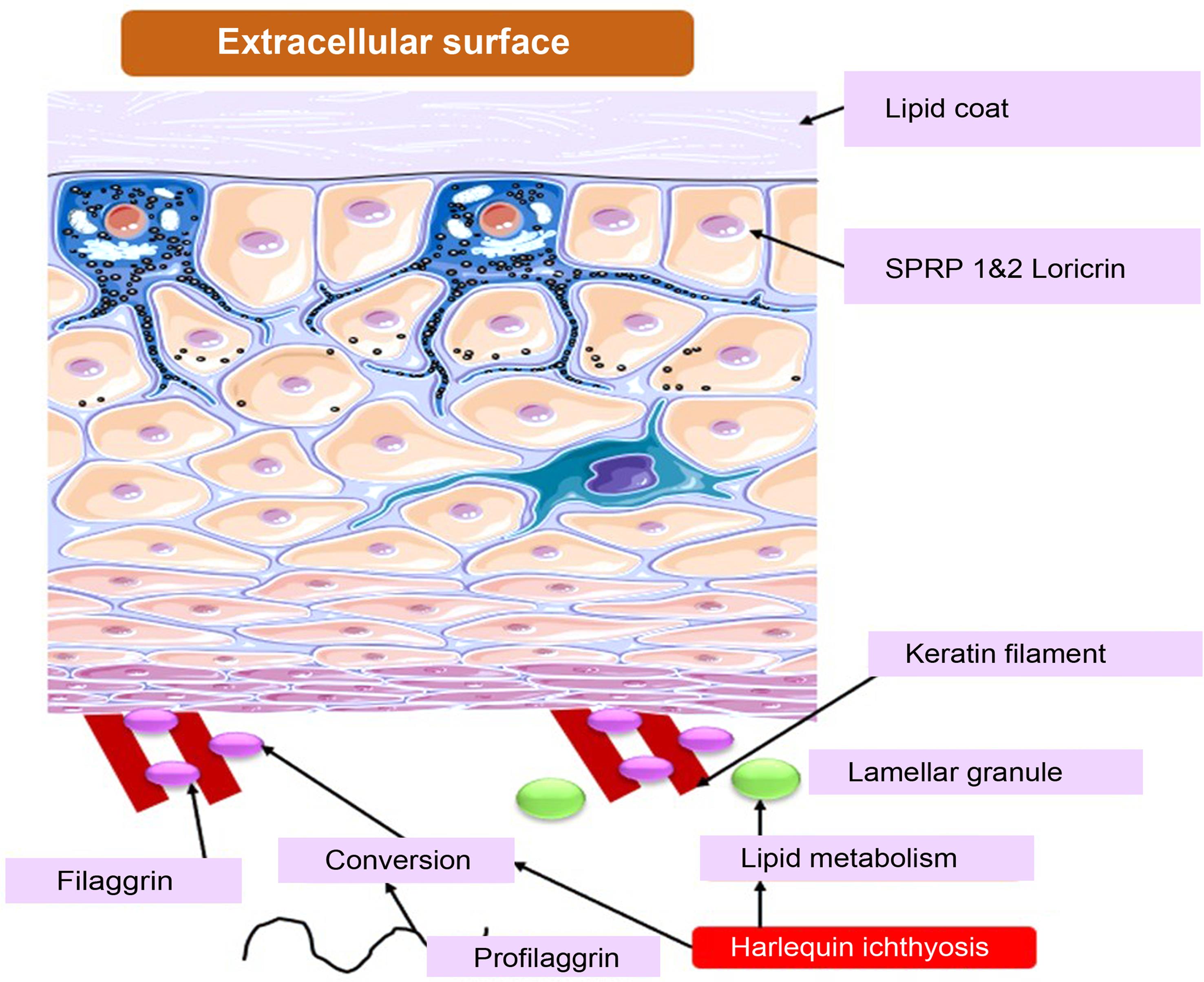 The pathophysiology of genetic ichthyoses includes the composition of the cellular surface region of cornified cells.