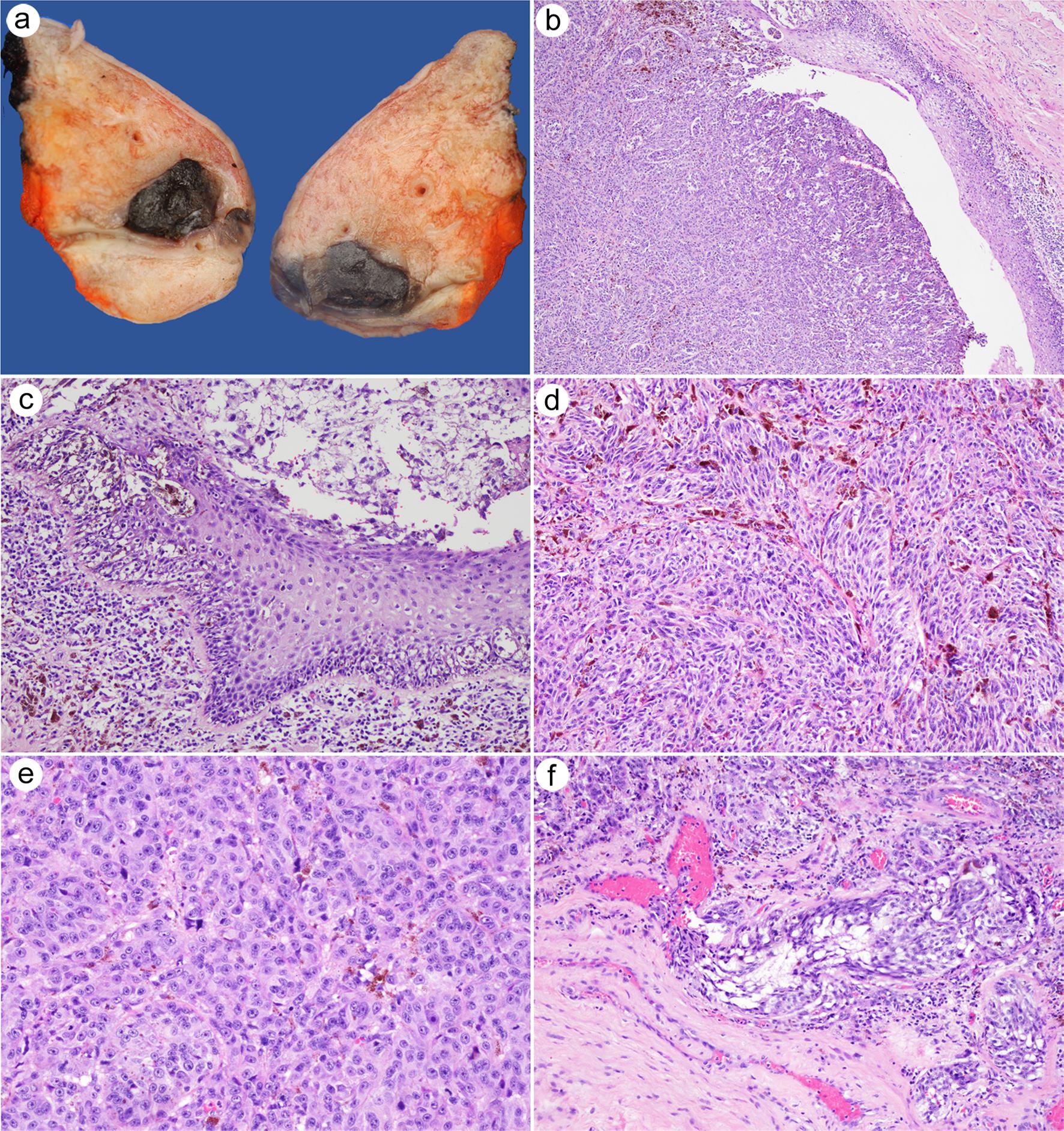 Images of the partial penectomy specimen.