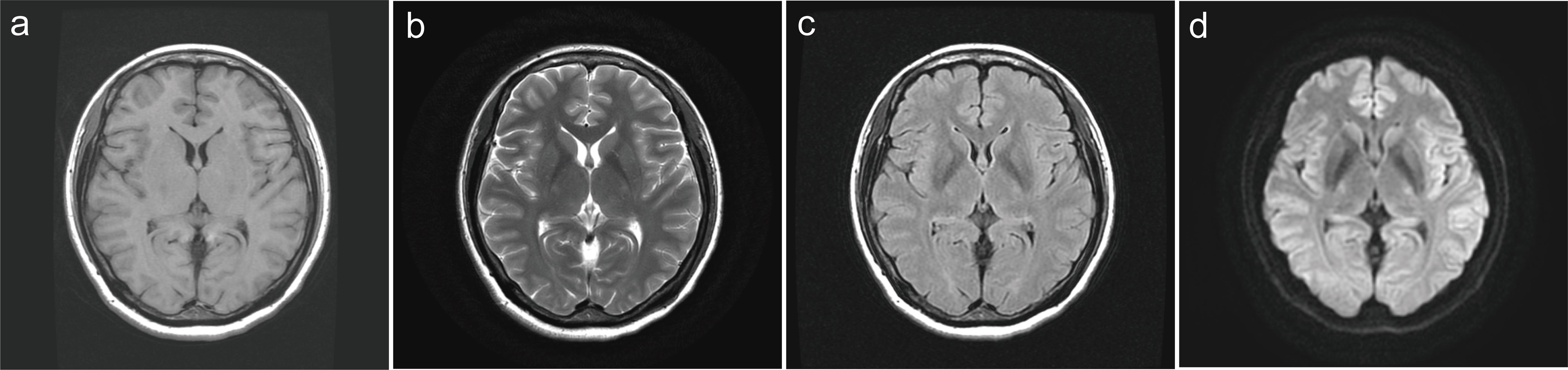 Cranial magnetic resonance routine scan images.
