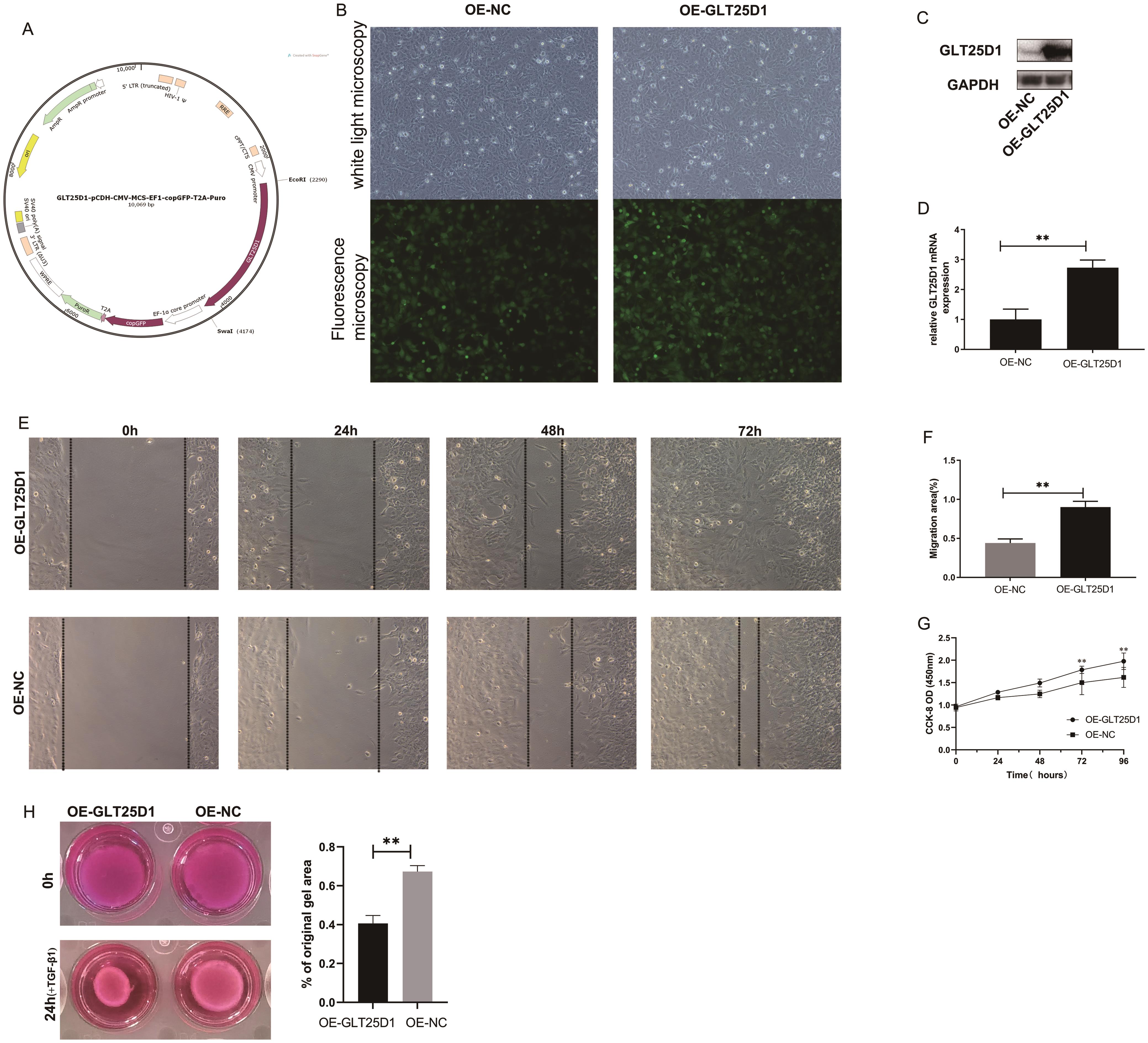 GLT25D1 overexpression activates LX-2 cells and their corresponding phenotypes.