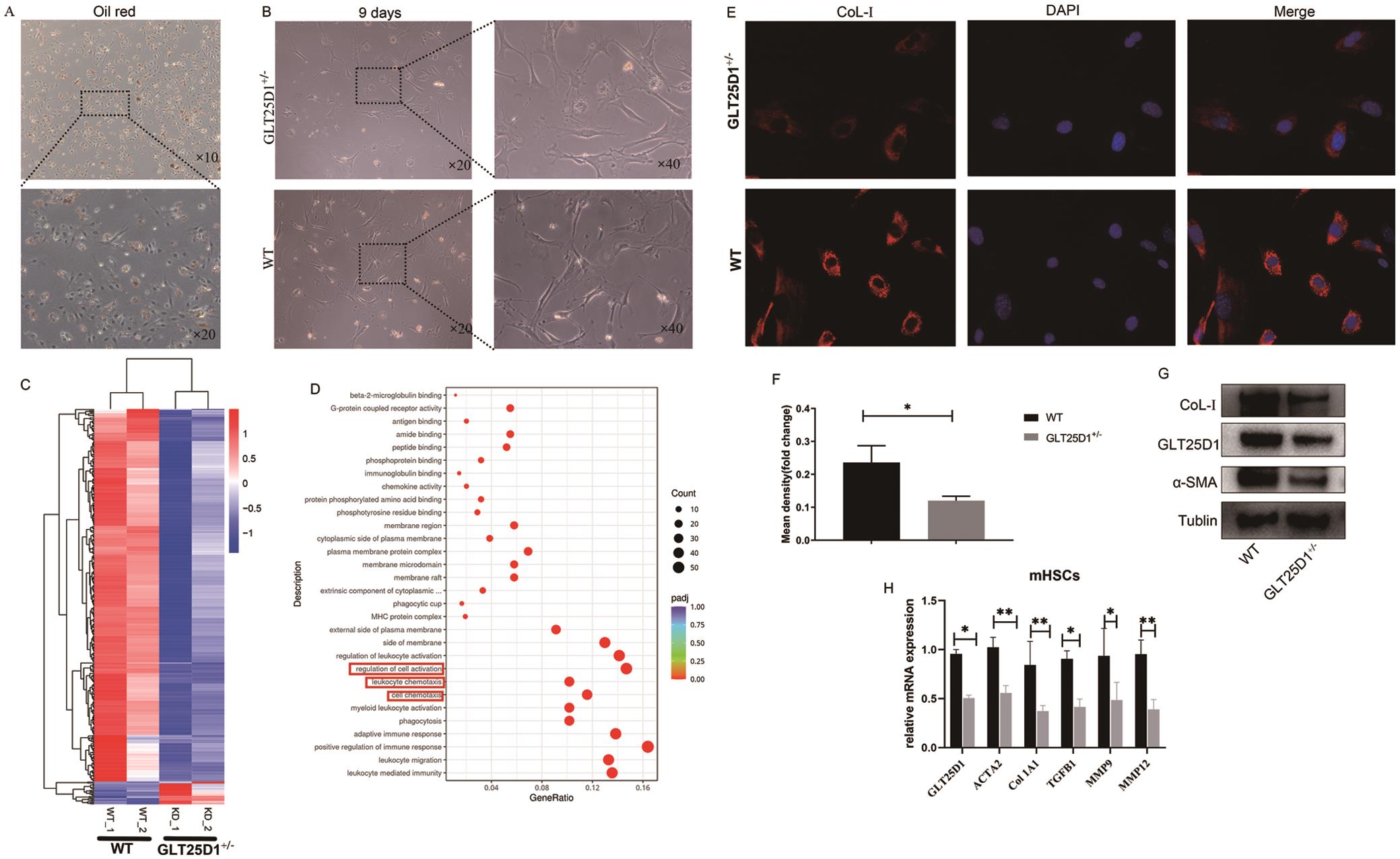 Knocking down GLT25D1 inhibits murine hepatic stellate cell (mHSC) activation and collagen expression.