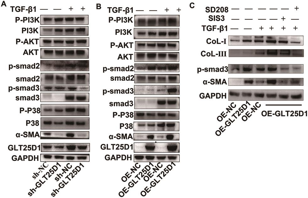 GLT25D1 drives LX-2 cell activation through the TGF-β1/SMAD3 signaling pathway.