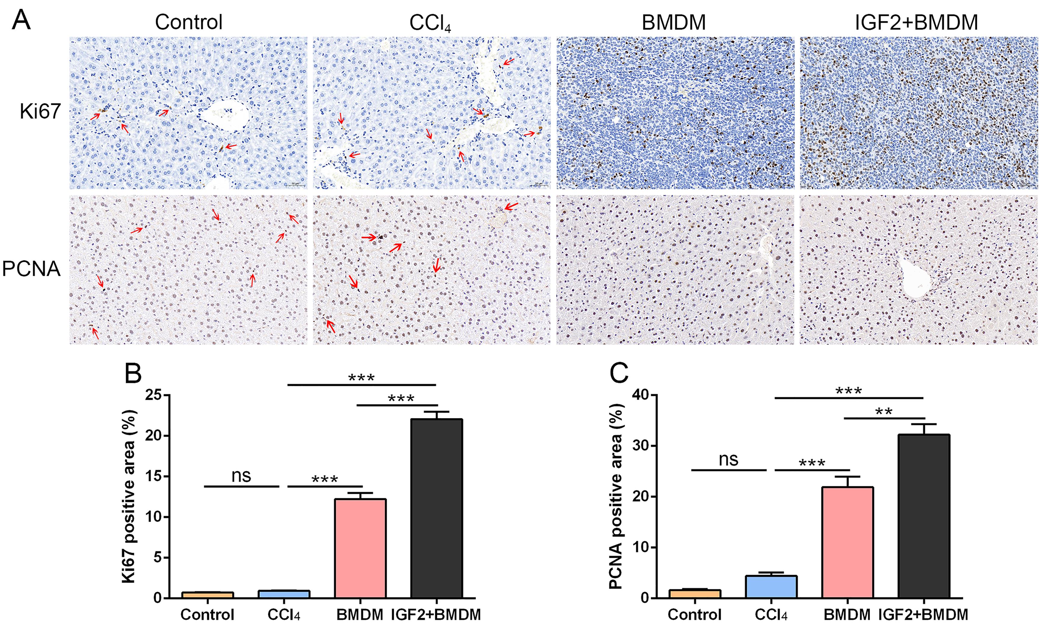 Combining IGF2 with BMDM promotes hepatocyte regeneration in cirrhotic mice.