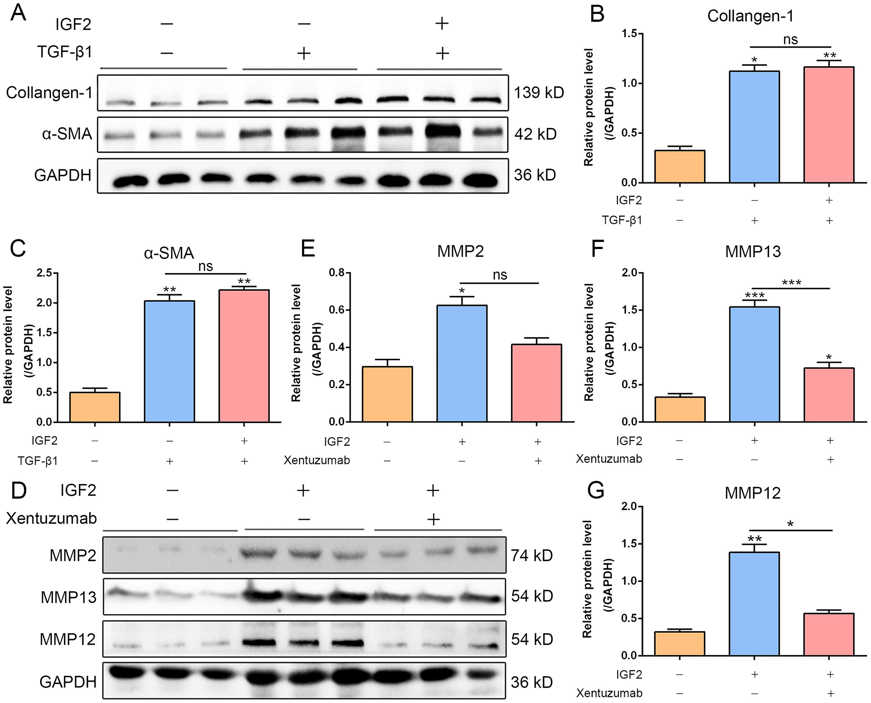 The IGF2-NR4A2 pathway alleviates liver cirrhosis by inducing matrix metalloproteinases in macrophages.