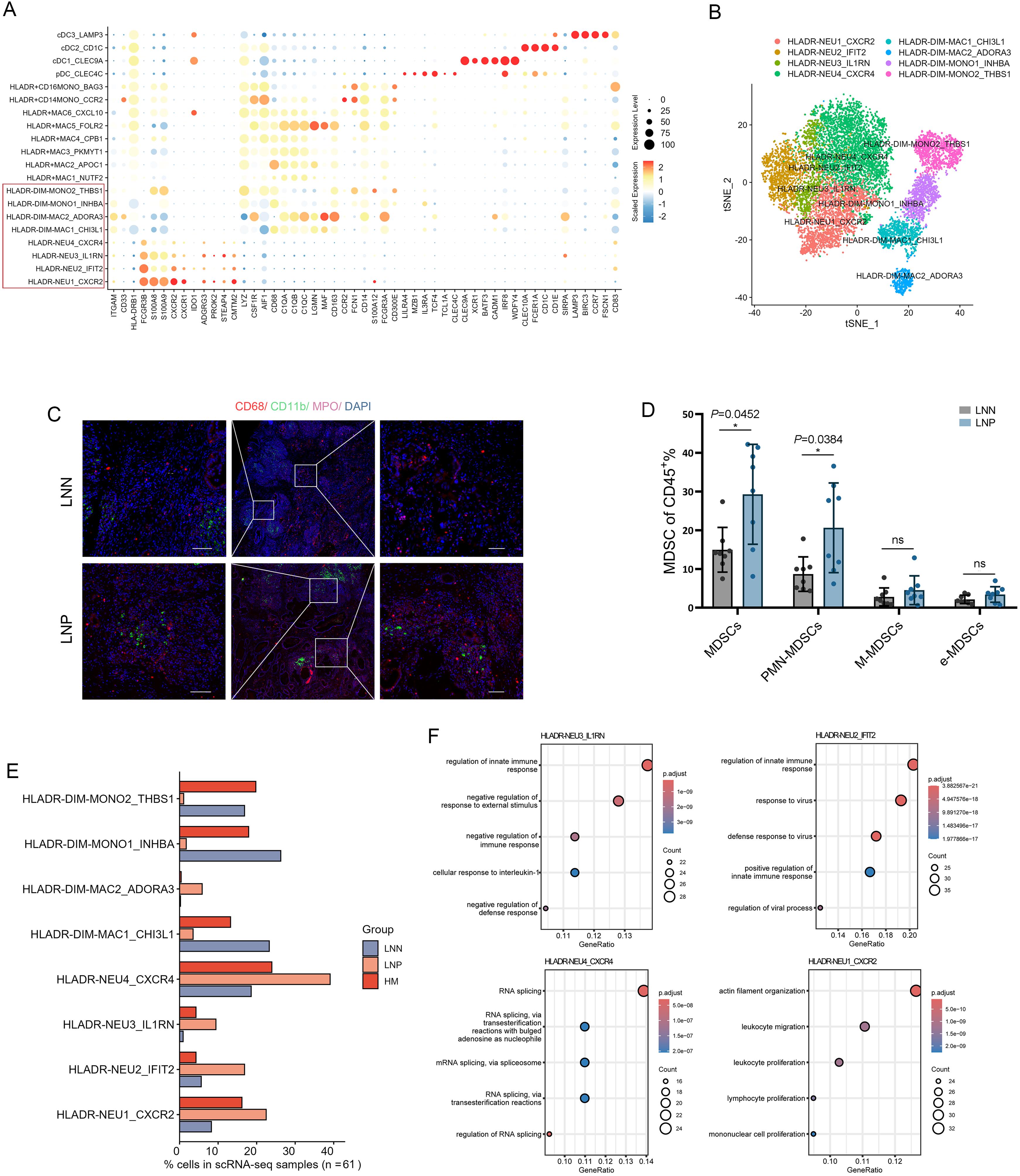 Lymph node-positive PDAC tissues show increased MDSC recruitment.
