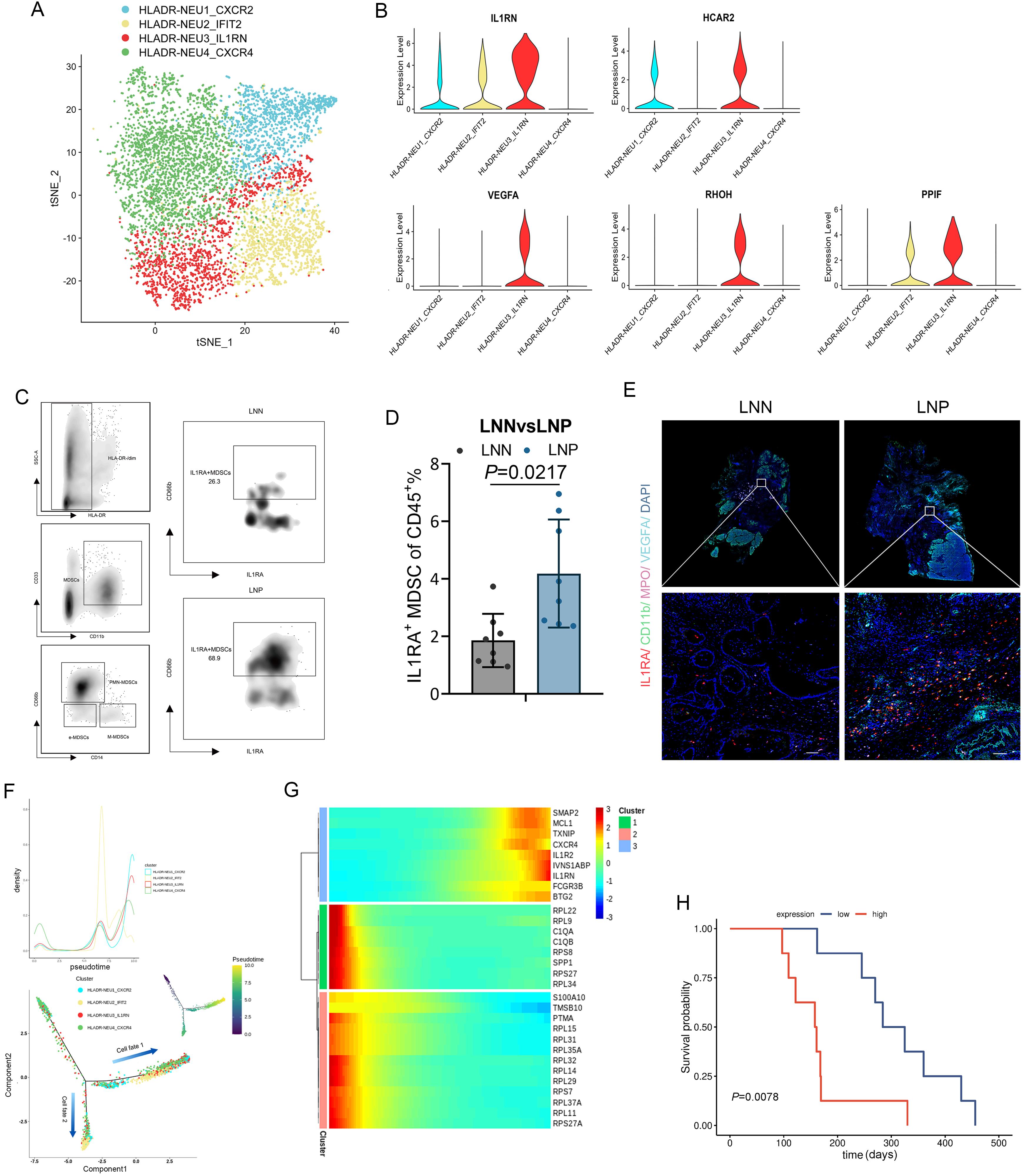IL1RA<sup>+</sup> MDSCs increase in LNP PDAC and correlate with worse survival outcomes.