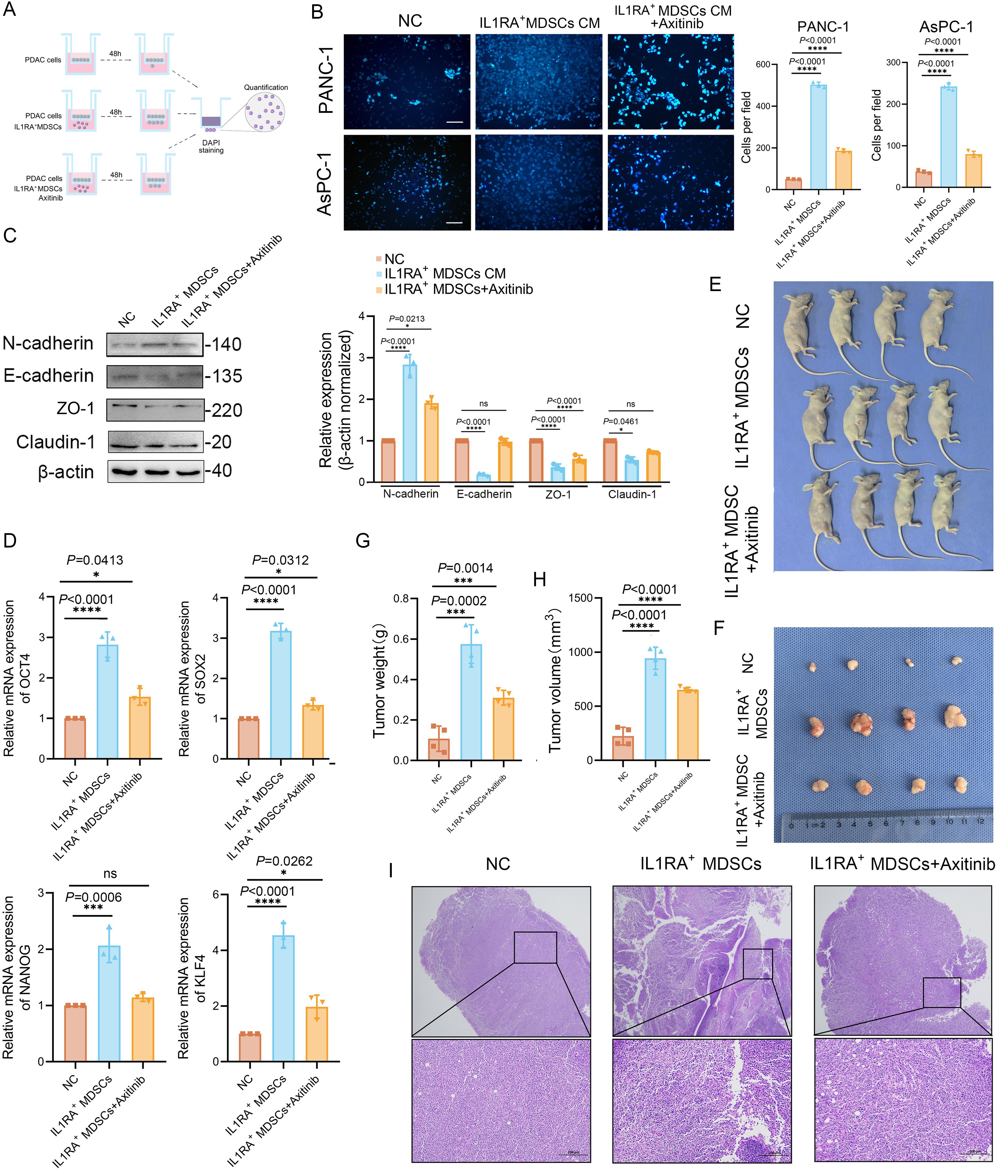 <italic>IL1RN</italic><sup>+</sup> MDSCs promote PDAC progression <italic>in vitro</italic> and <italic>in vivo.</italic>