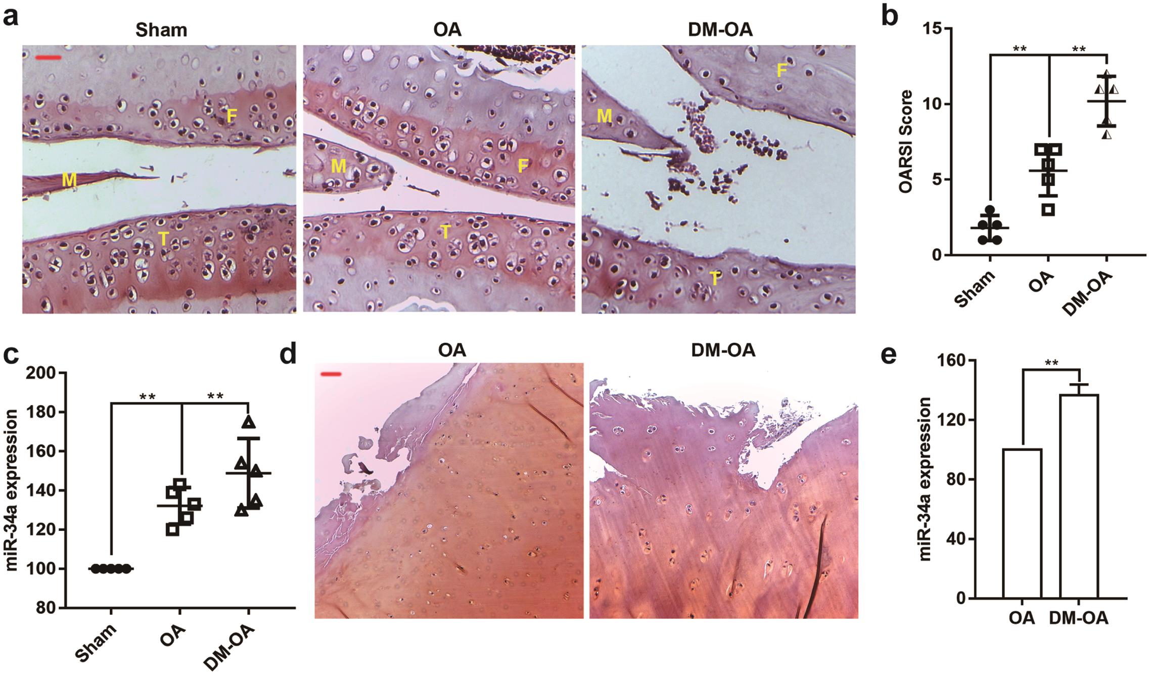 MicroRNA-34a expression is elevated in diabetic osteoarthritis cartilage.