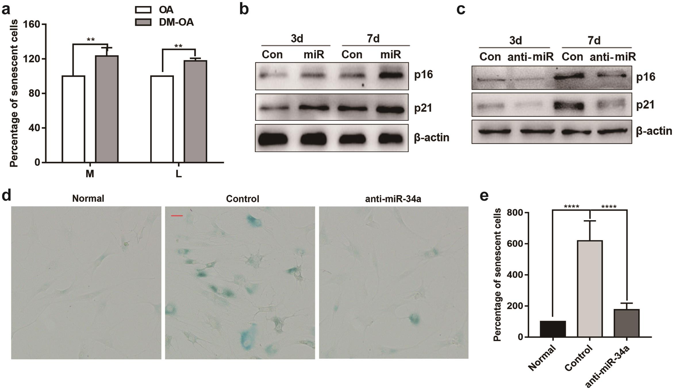 MicroRNA-34a is a critical regulator of chondrocyte senescence.