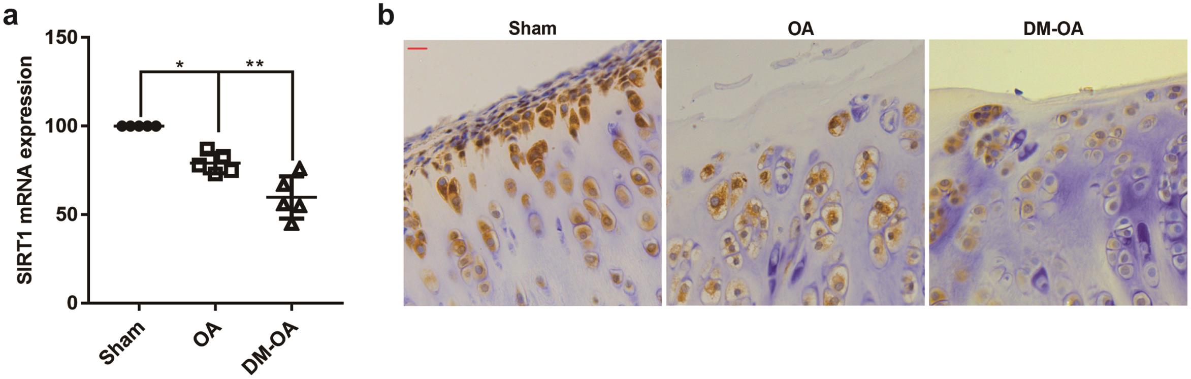Sirtuin 1 expression is reduced diabetic osteoarthritis cartilage.
