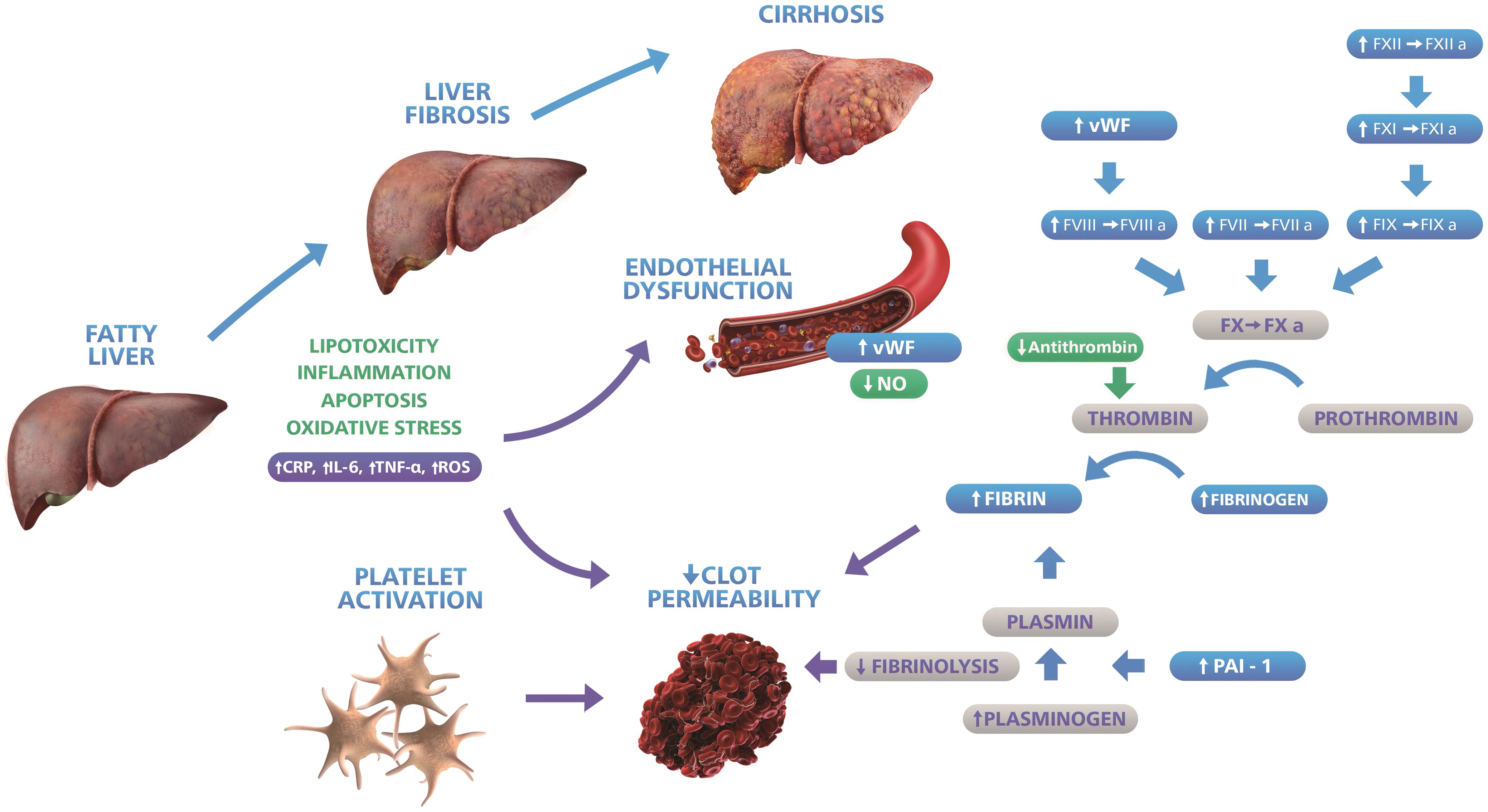 Possible alterations in the coagulation cascade, fibrinolysis, platelet and ED associated with non-alcoholic fatty liver disease, with mechanisms responsible for potential prothrombotic and procoagulant imbalance in patients with NAFLD.