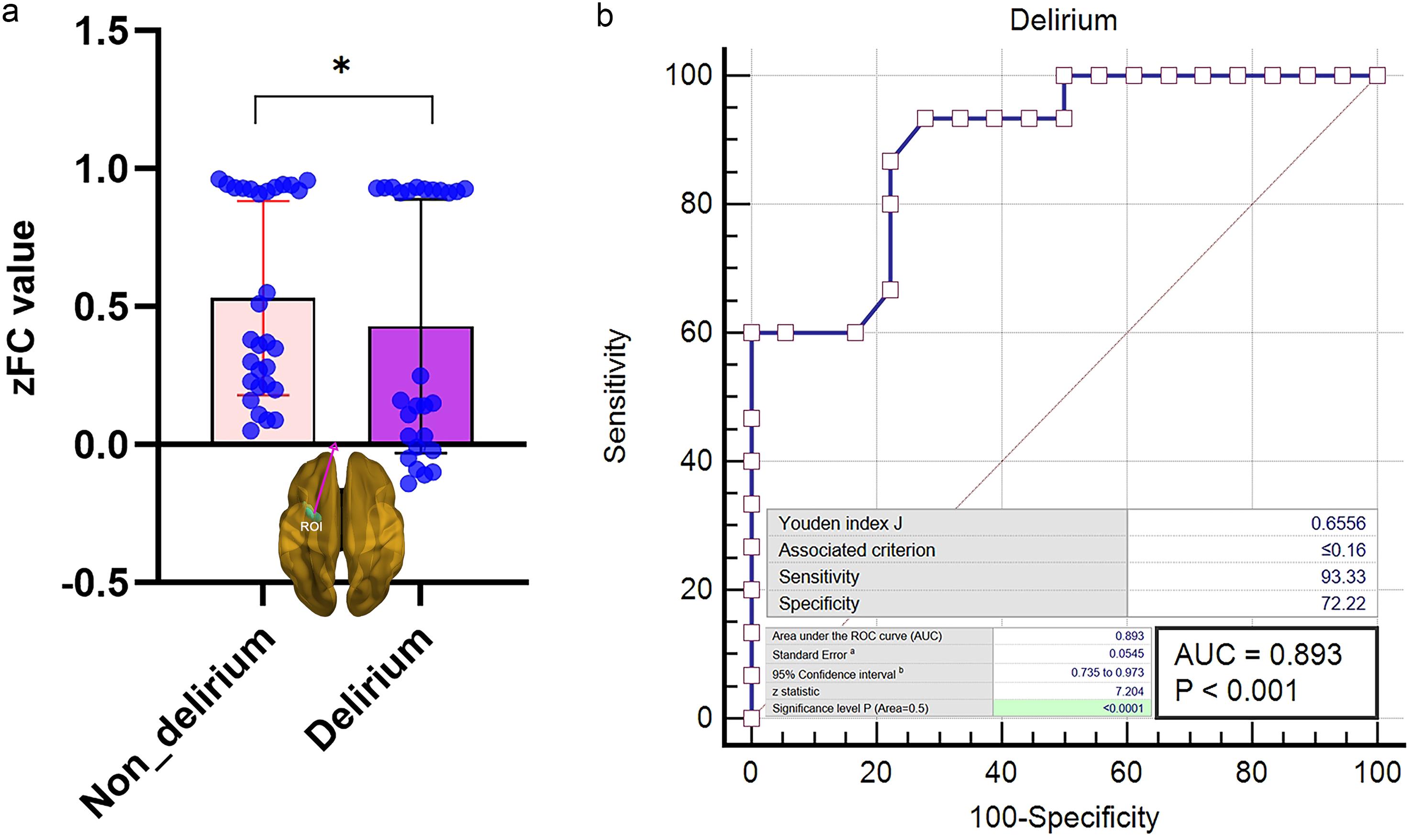 The parahippocampal gyrus brain region was anchored as the region of interest for further analysis.