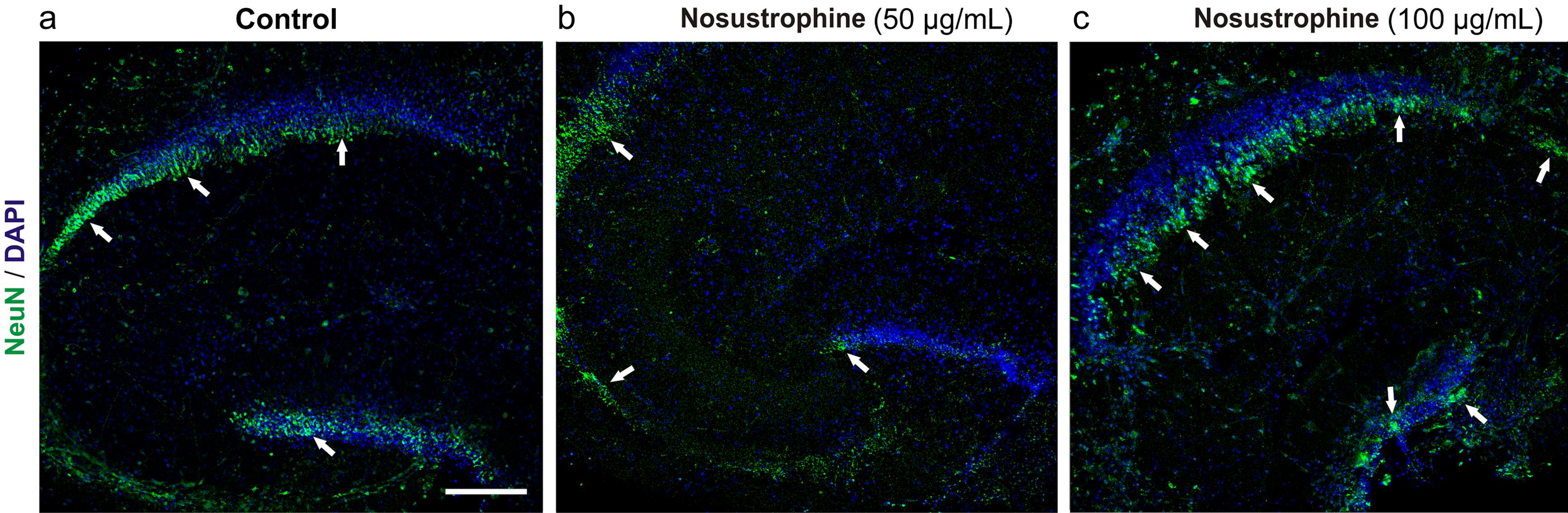 Nosustrophine is protective against Aβ1-42-induced neurodegeneration in organotypic hippocampal slice cultures.