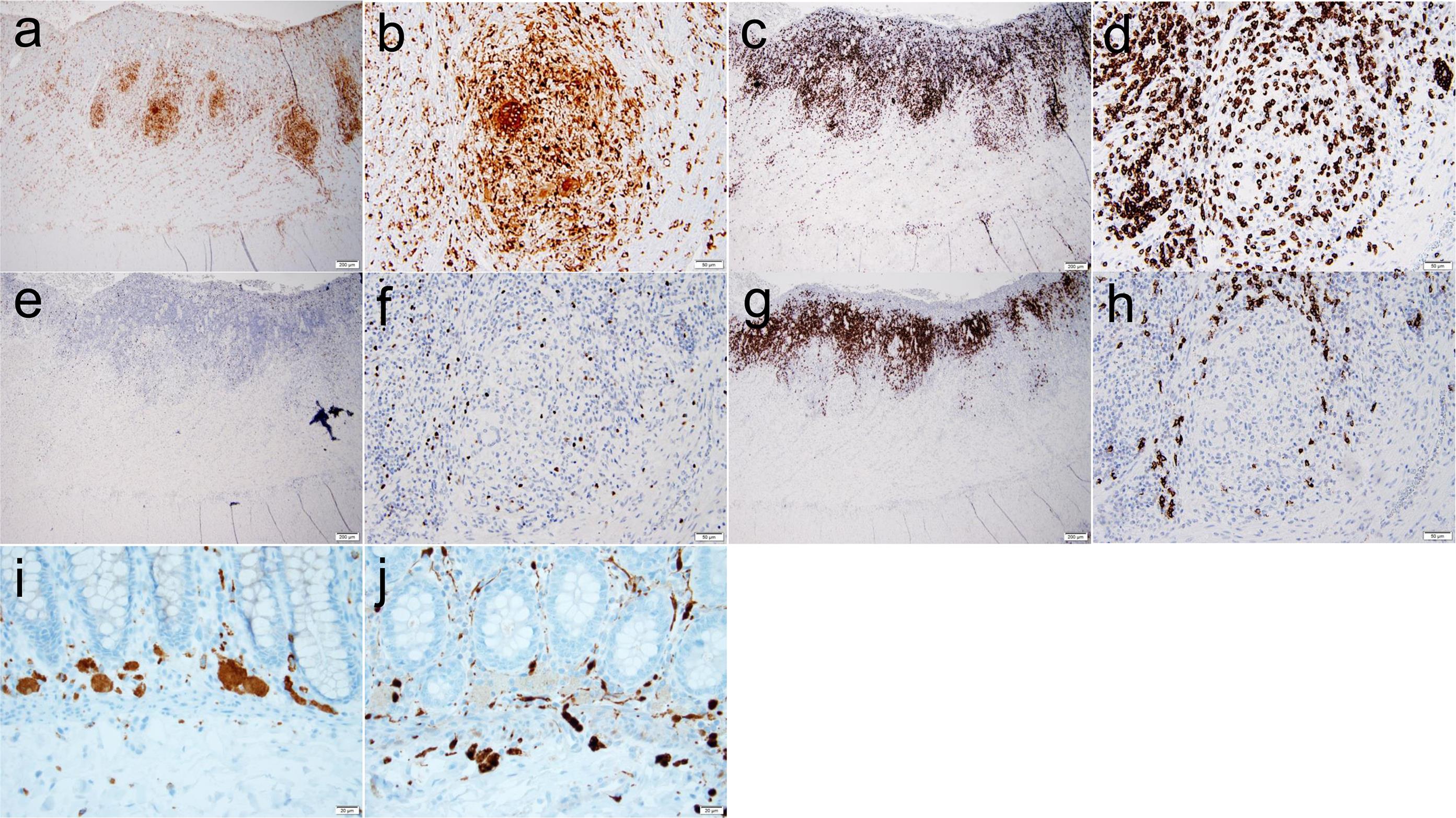 Histochemical and Immunohistochemical Features in Hermansky-Pudlak syndrome (HPS).