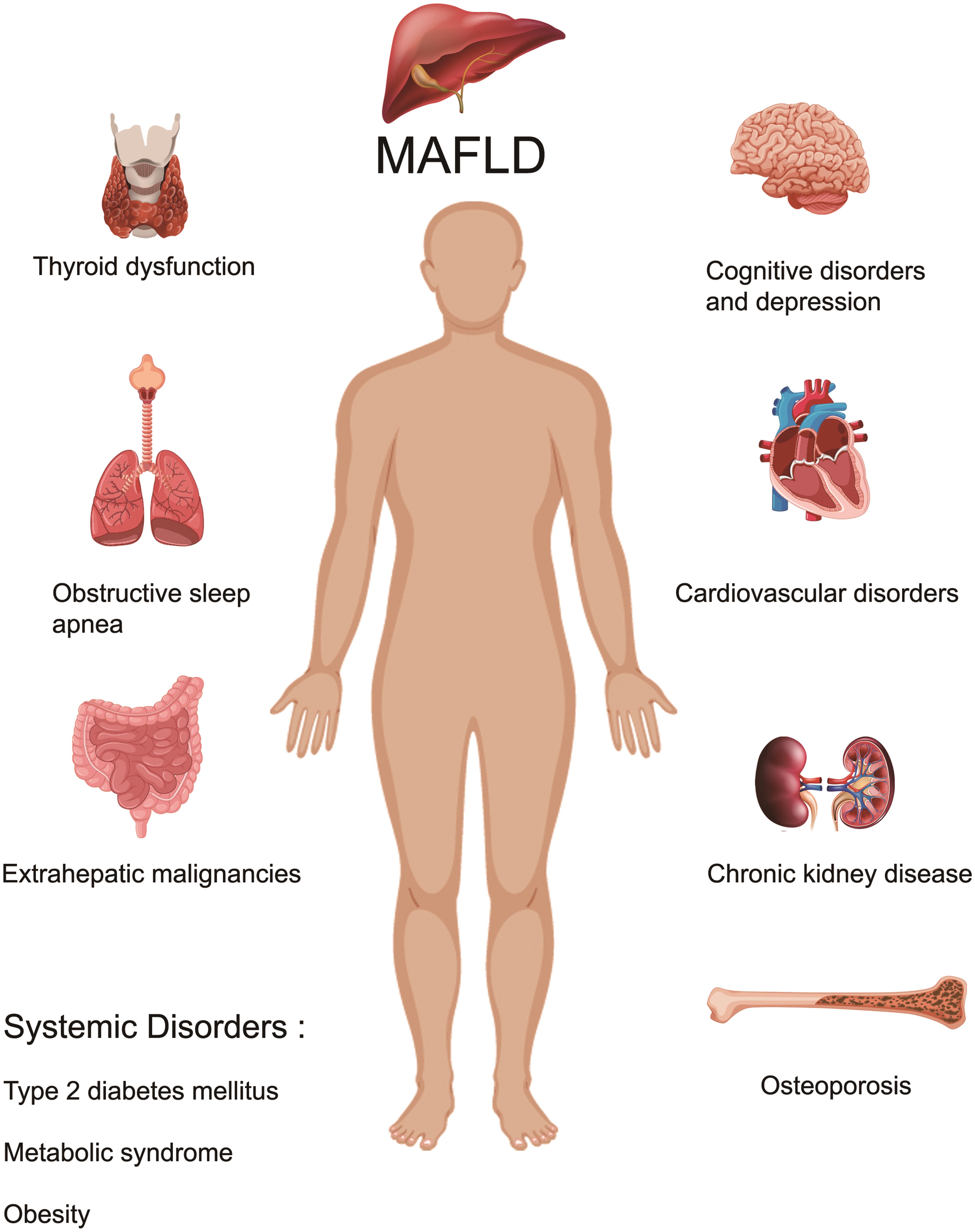MAFLD and its association with extrahepatic diseases.