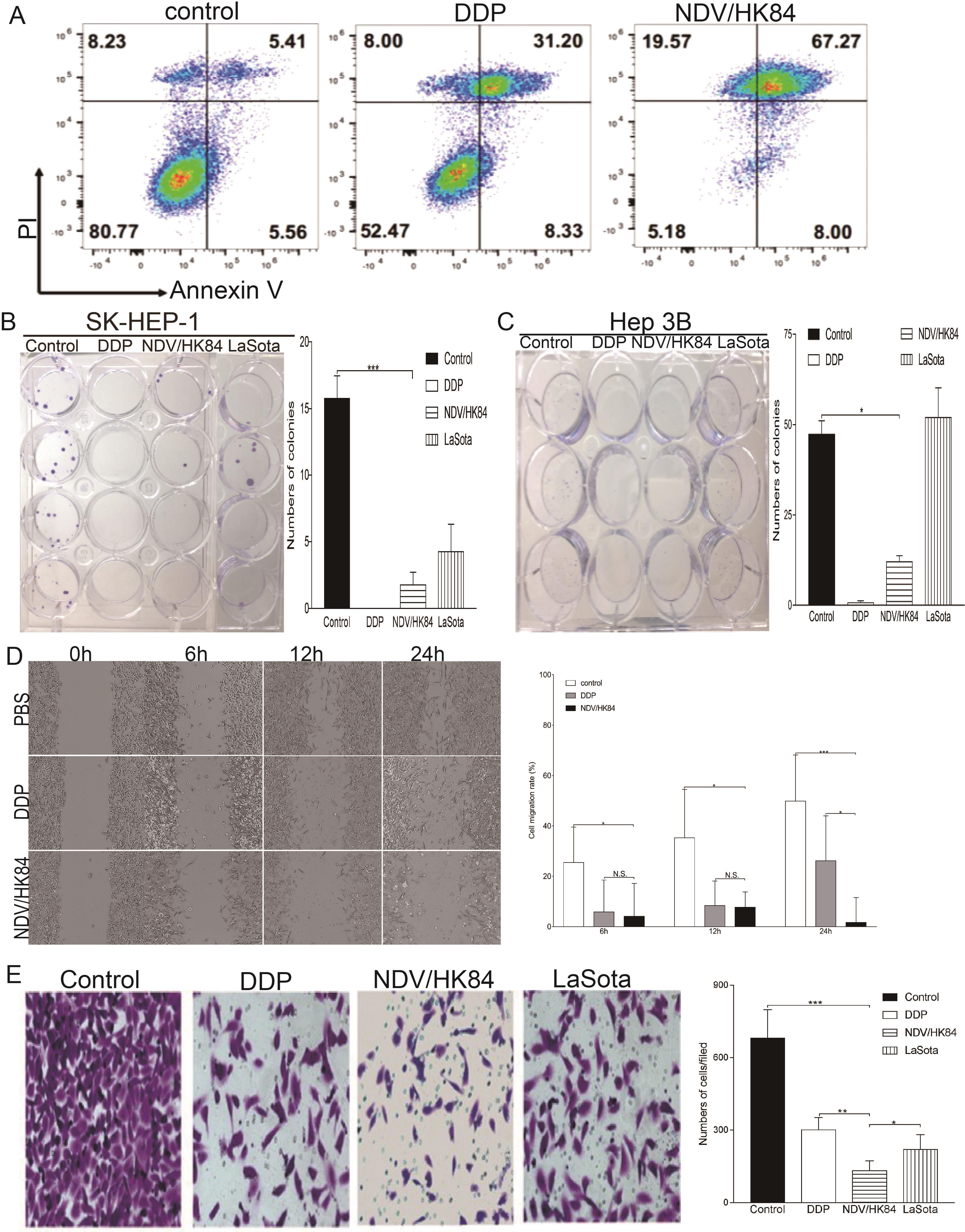 NDV/HK84 induced apoptosis, and inhibited proliferation, migration, and invasiveness on HCC cells.
