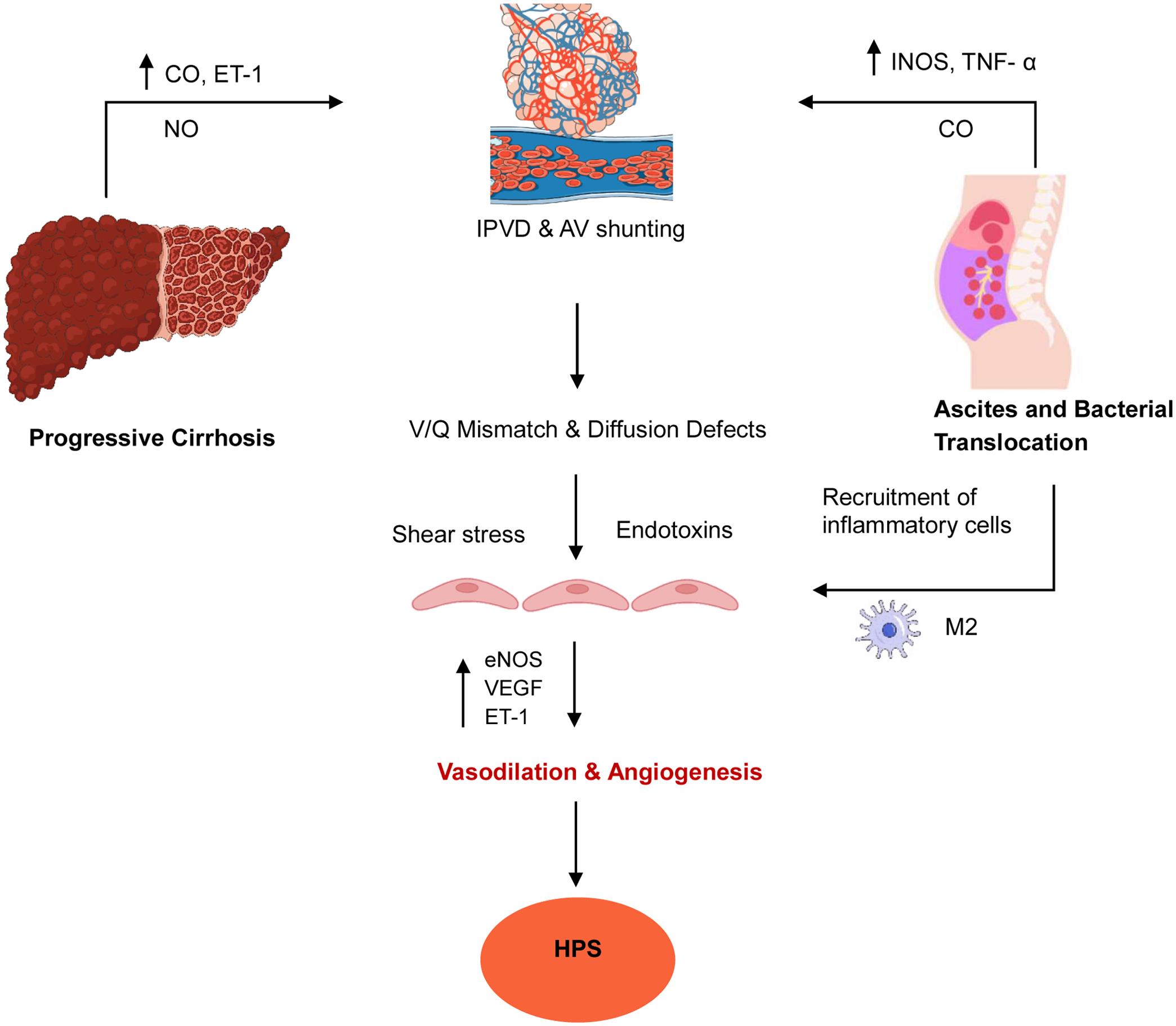 Pathophysiology of Hepatopulmonary syndrome (HPS).