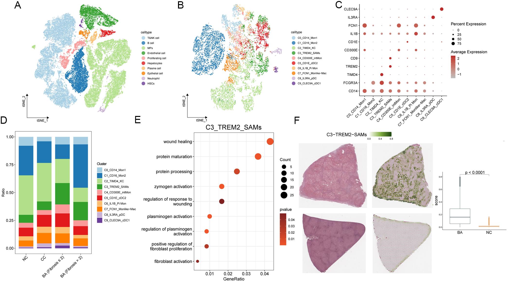 Single-cell and spatial transcriptomic characterization of scar-associated macrophages in BA.
