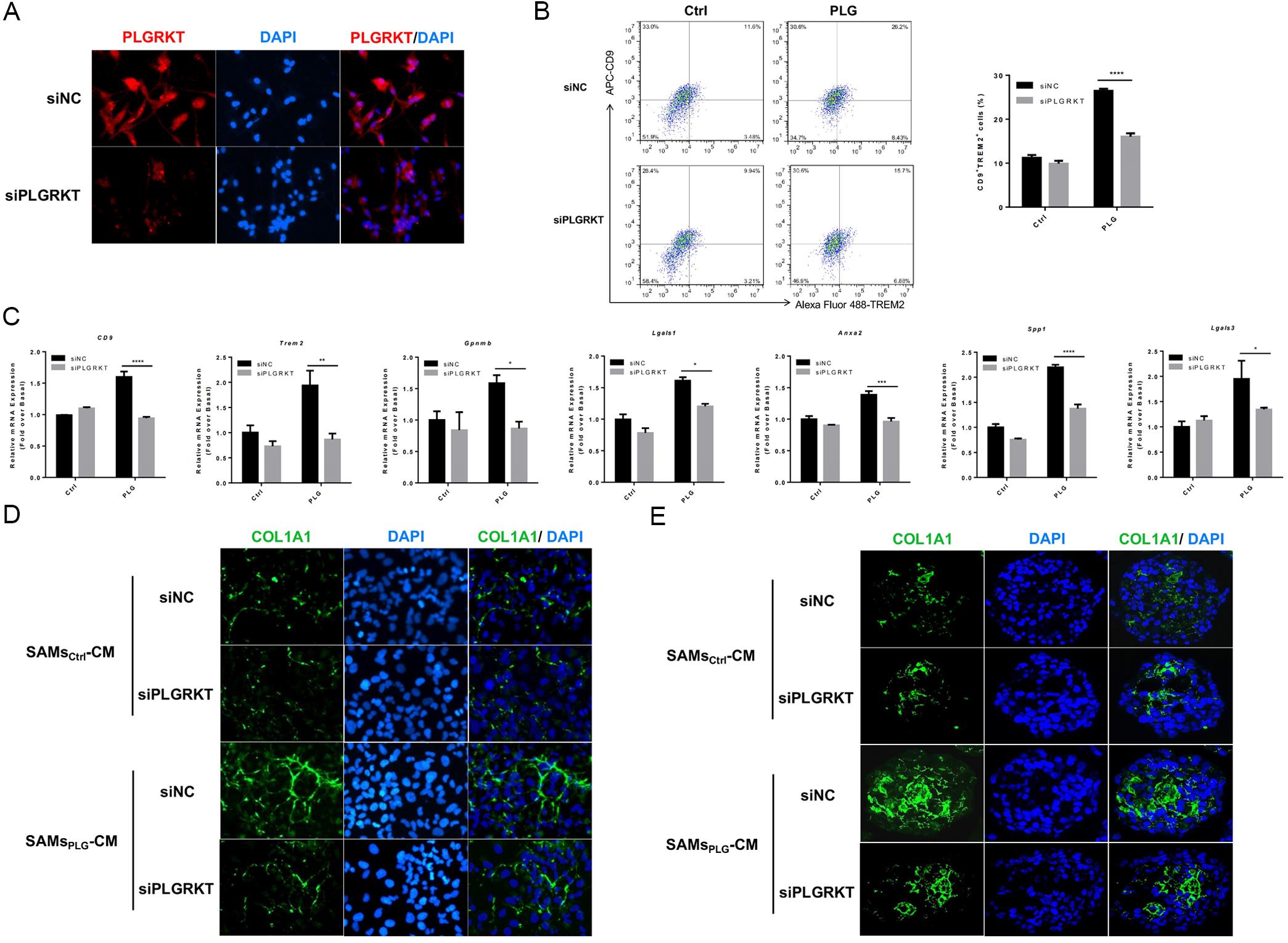 PLGRKT knockdown in macrophages and downstream effects <italic>in vitro</italic>.