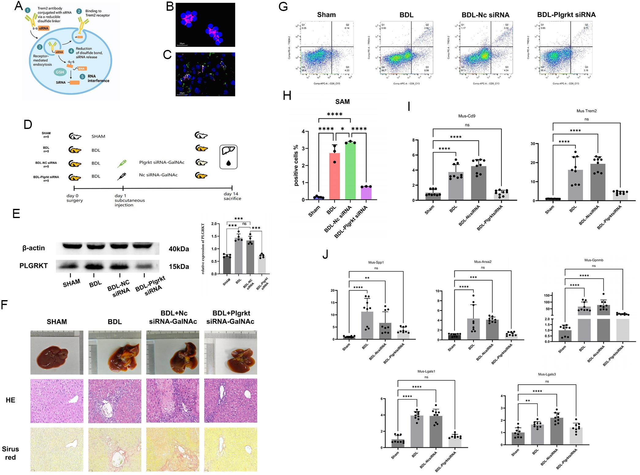 TREM2 antibody–siRNA conjugate-mediated <italic>Plgrkt</italic> knockdown in SAMs in BDL mice.