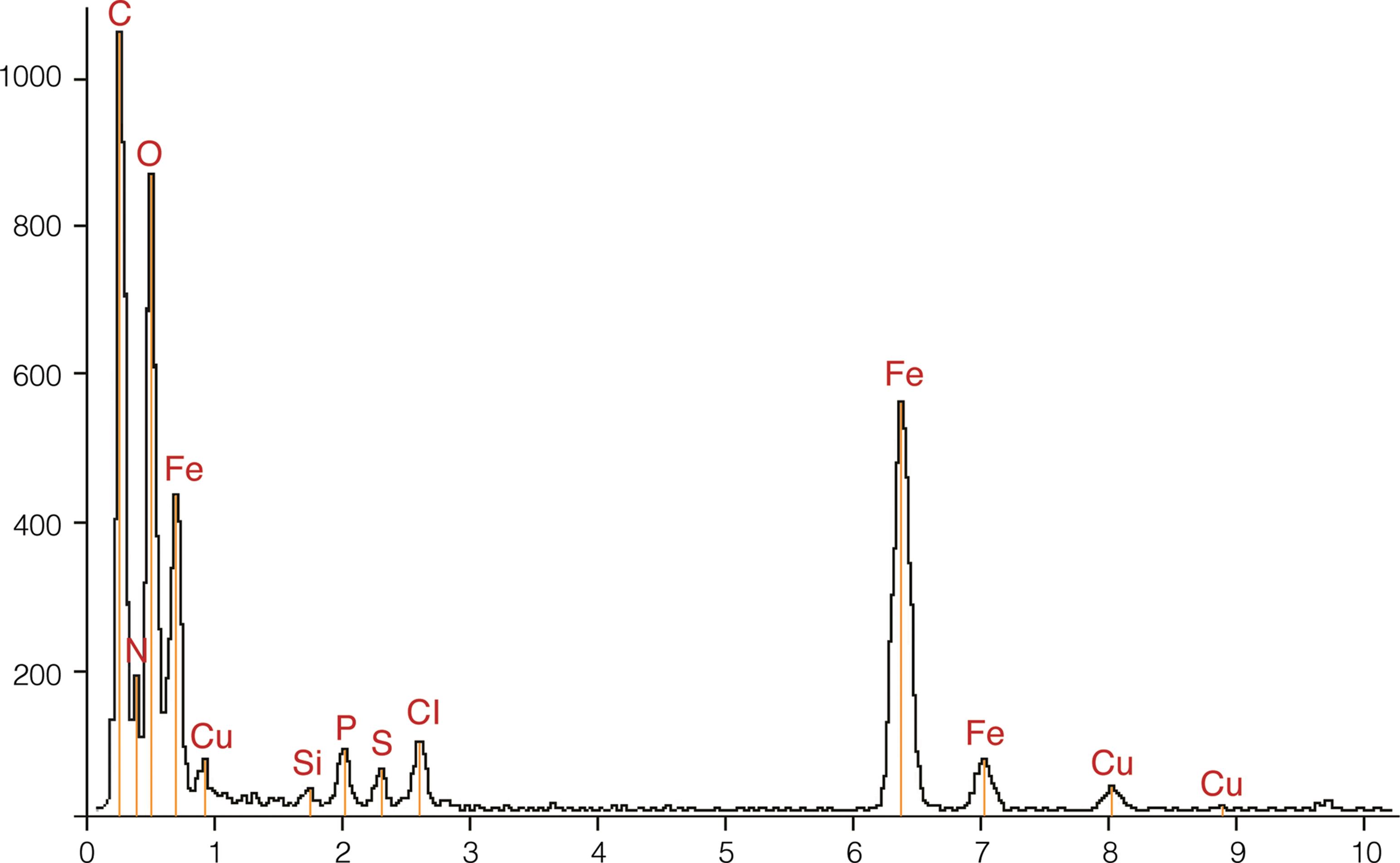 An X-ray spectrum of hepatocellular dense body in ferroportin disease.