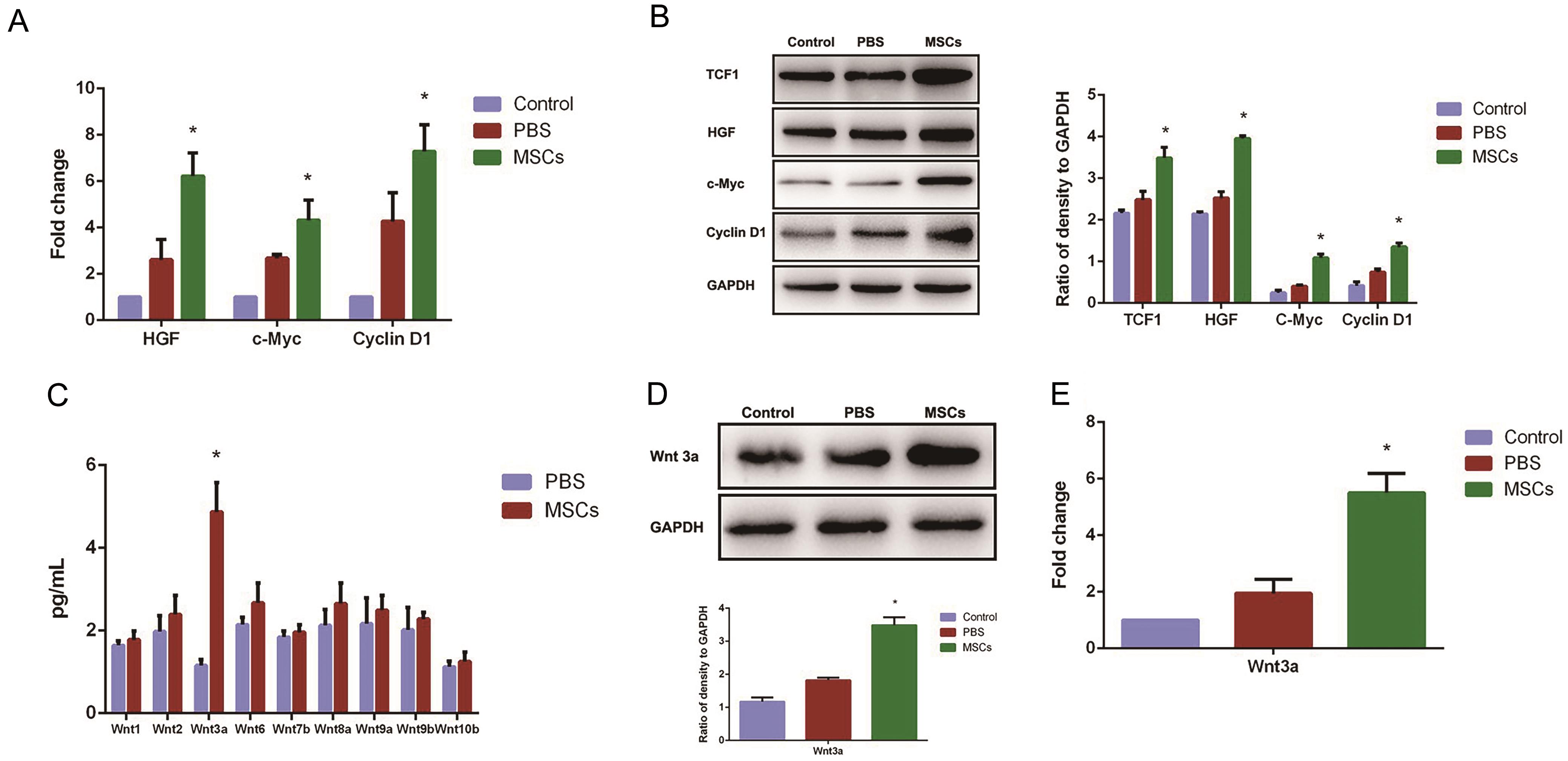 Mesenchymal stem cell (MSC) transplantation increased hepatic Wnt-3a mRNA and protein expression.