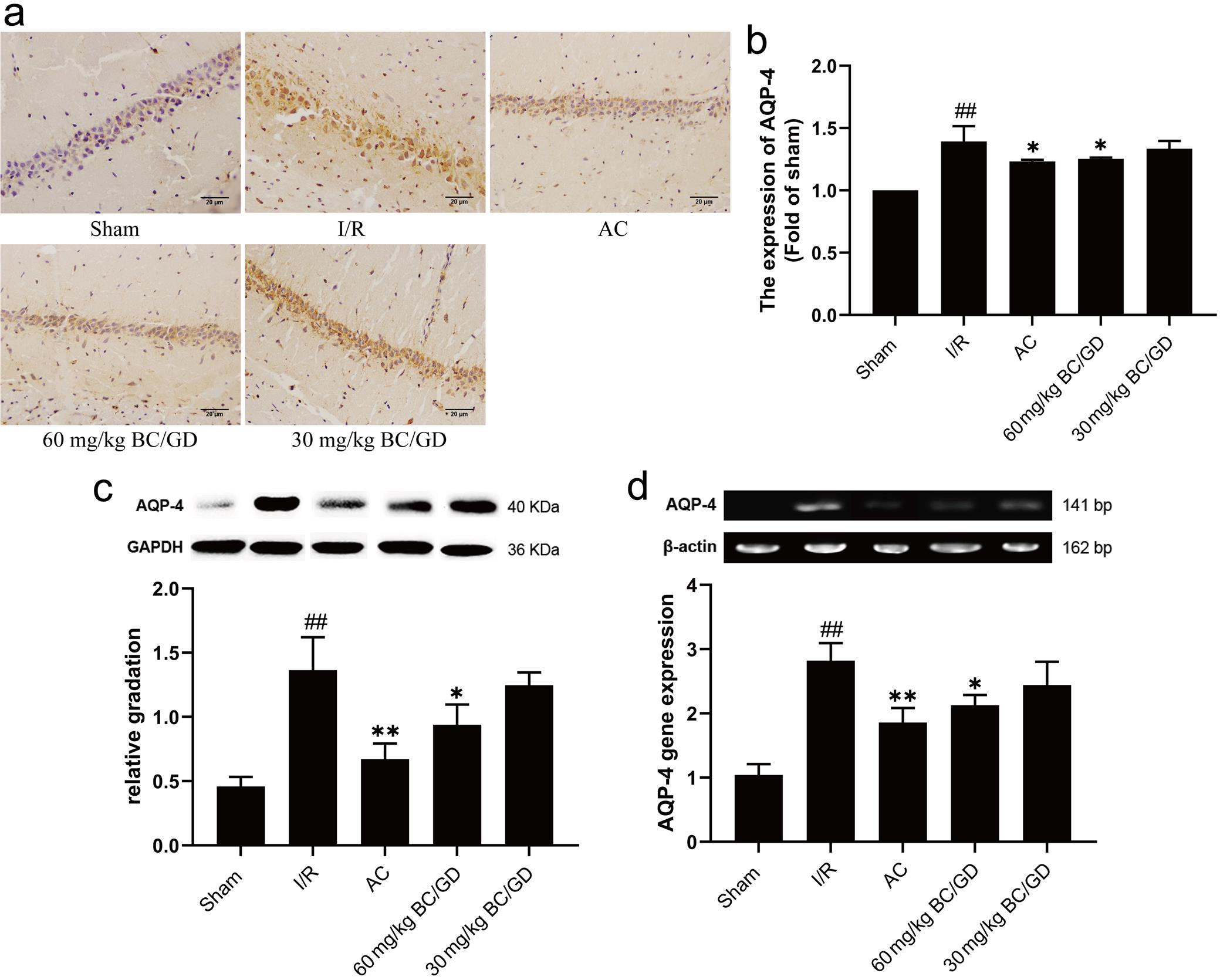 The expression of AQP-4 in hippocampus tissues in each group.