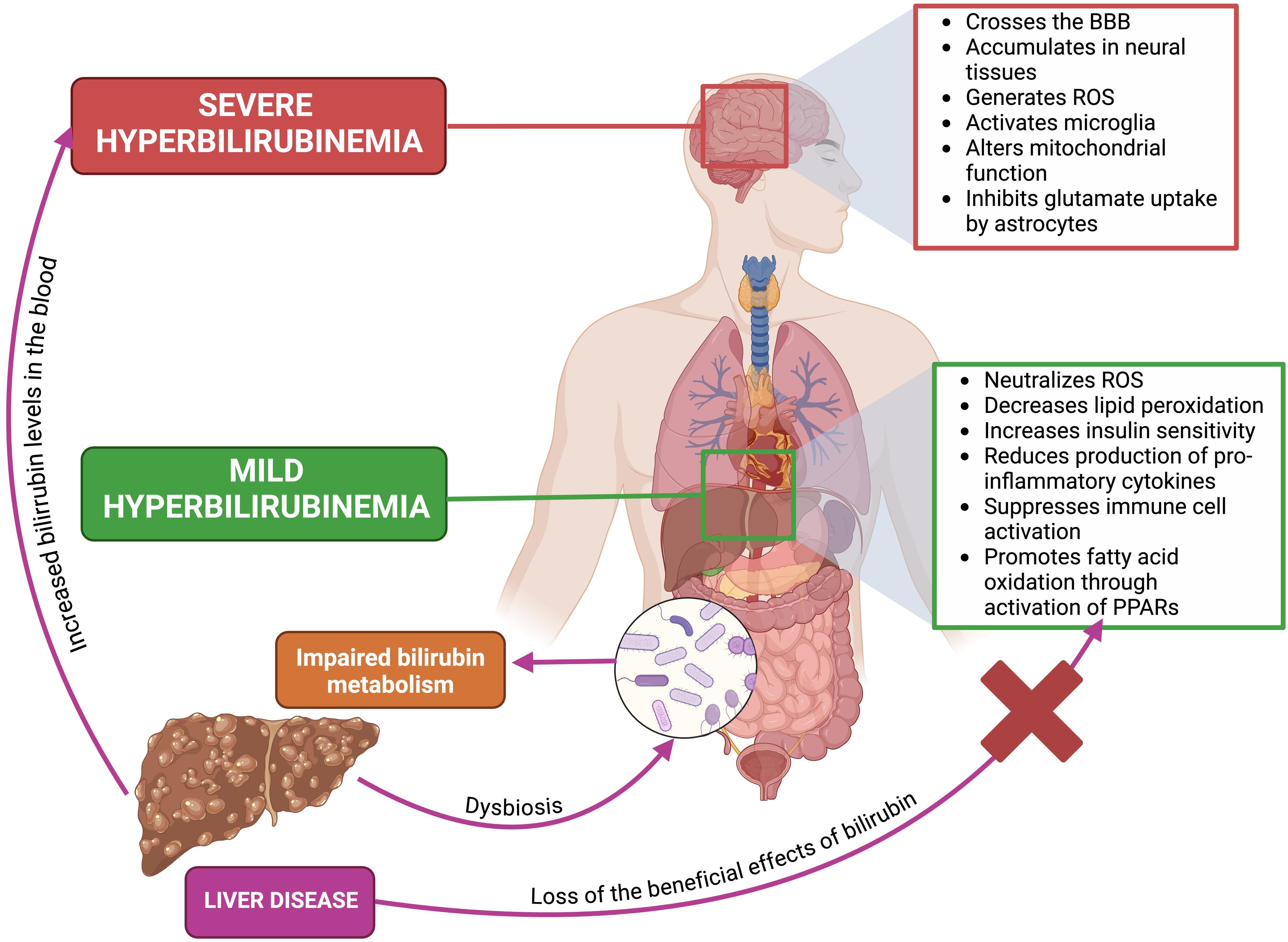 The dual roles of bilirubin in liver disease.