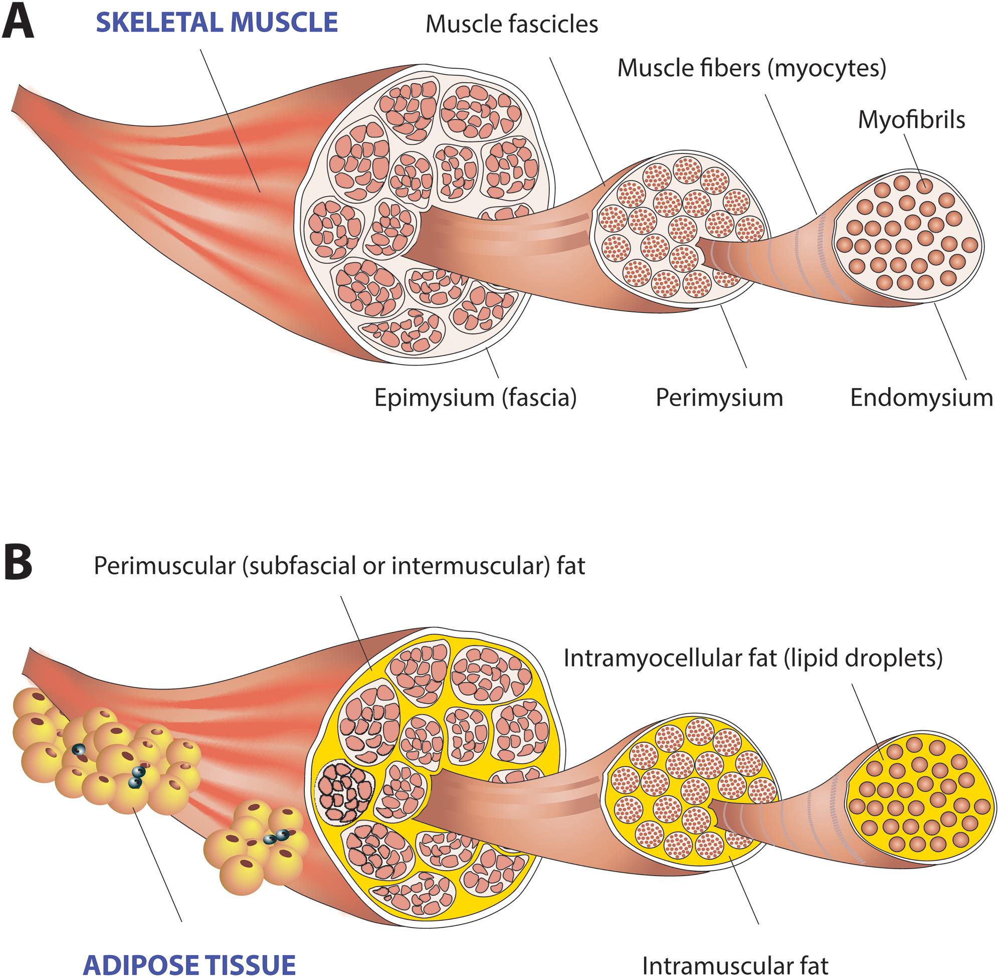 <bold>Skeletal muscle and fat deposition.</bold> (A) Skeletal muscle is made up of intramyocellular myofibrils, muscle fibers and fascicles bound together by successively thicker connective tissue layers as endomysium, perimysium, and epimysium. (B) Skeletal muscle fat may be classified as intramyocellular (lipid droplets filling the cytoplasm between myofibrils of elongated myocytes) and extramyocellular components. Adipocytes may infiltrate muscle fibers (intramuscular fat), fascicles (intermuscular fat), or exist around the epimysium as extramuscular fat depots of adipose tissue.