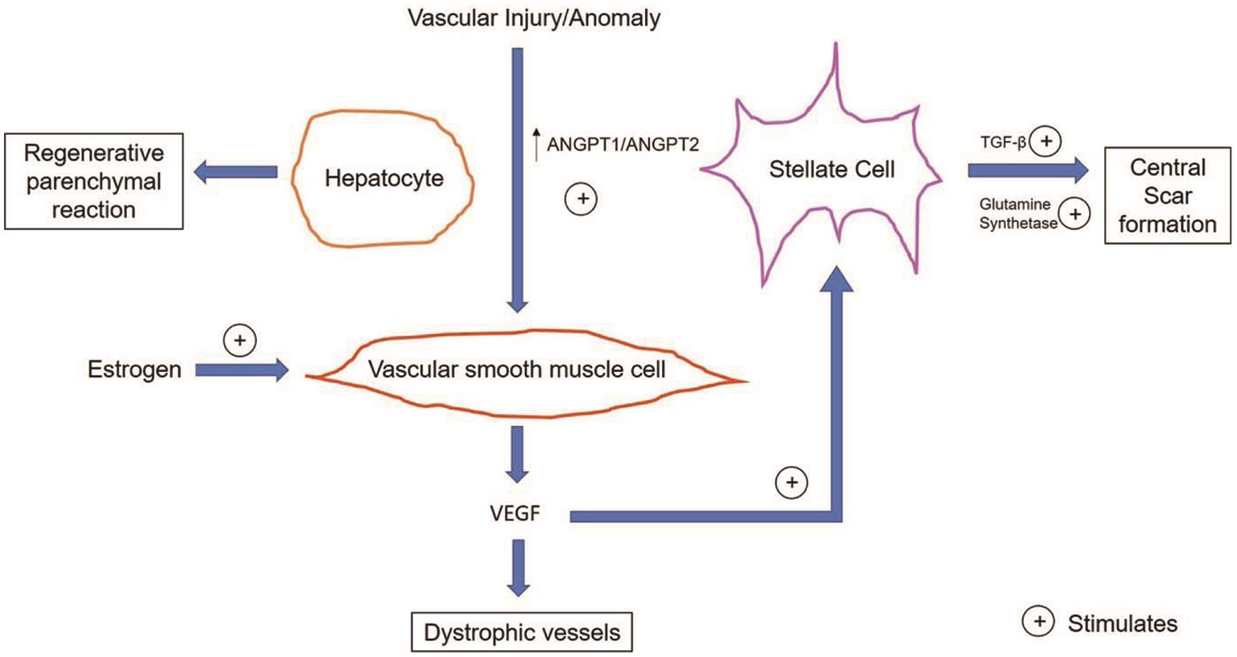 Proposed mechanisms of pathogenesis of FNH.