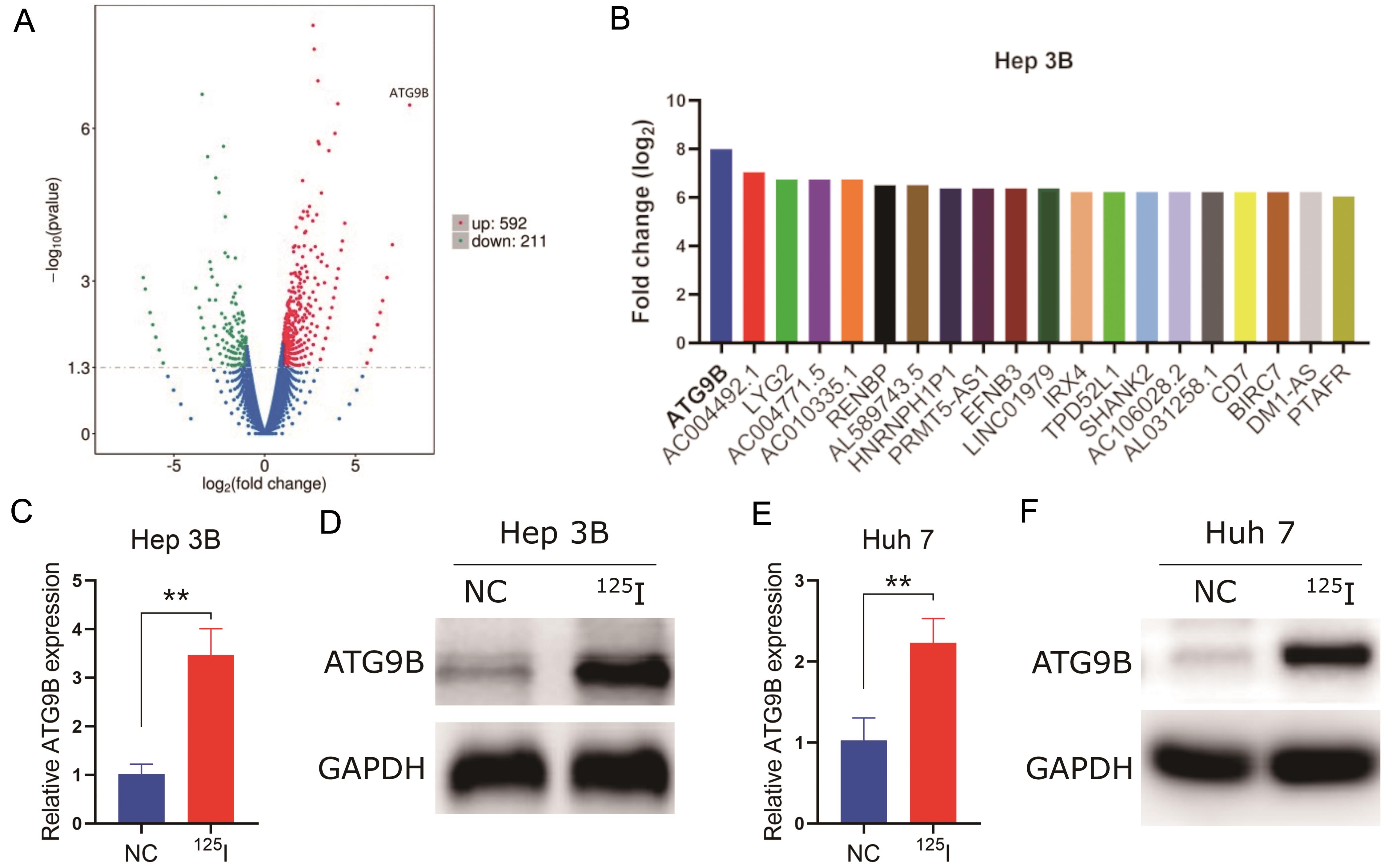<sup>125</sup>I particles increase ATG9B expression in HCC cells.