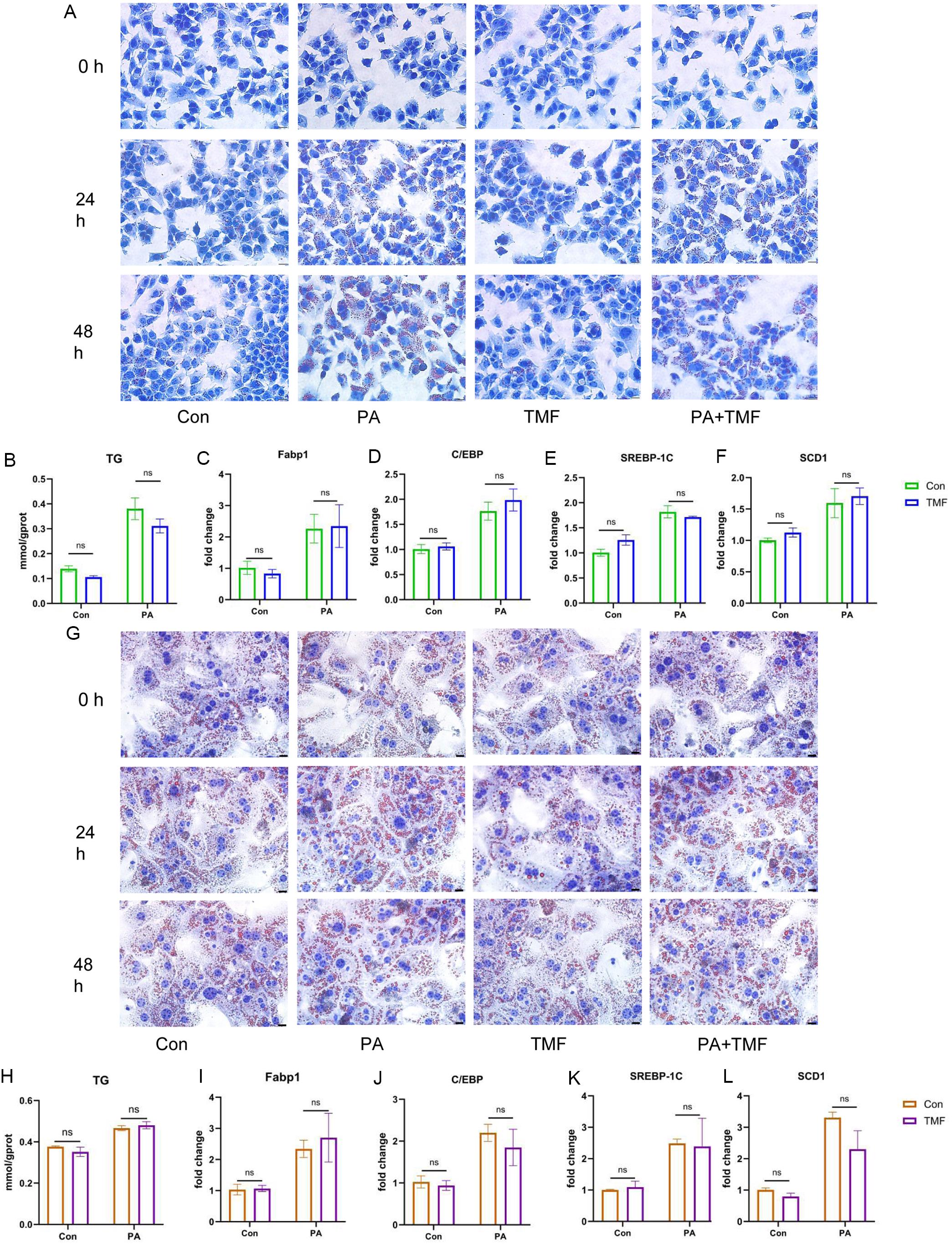 Effect of TMF on lipid accumulation and lipogenic gene expression in AML12 cell lines and primary hepatocytes <italic>in vitro</italic>.