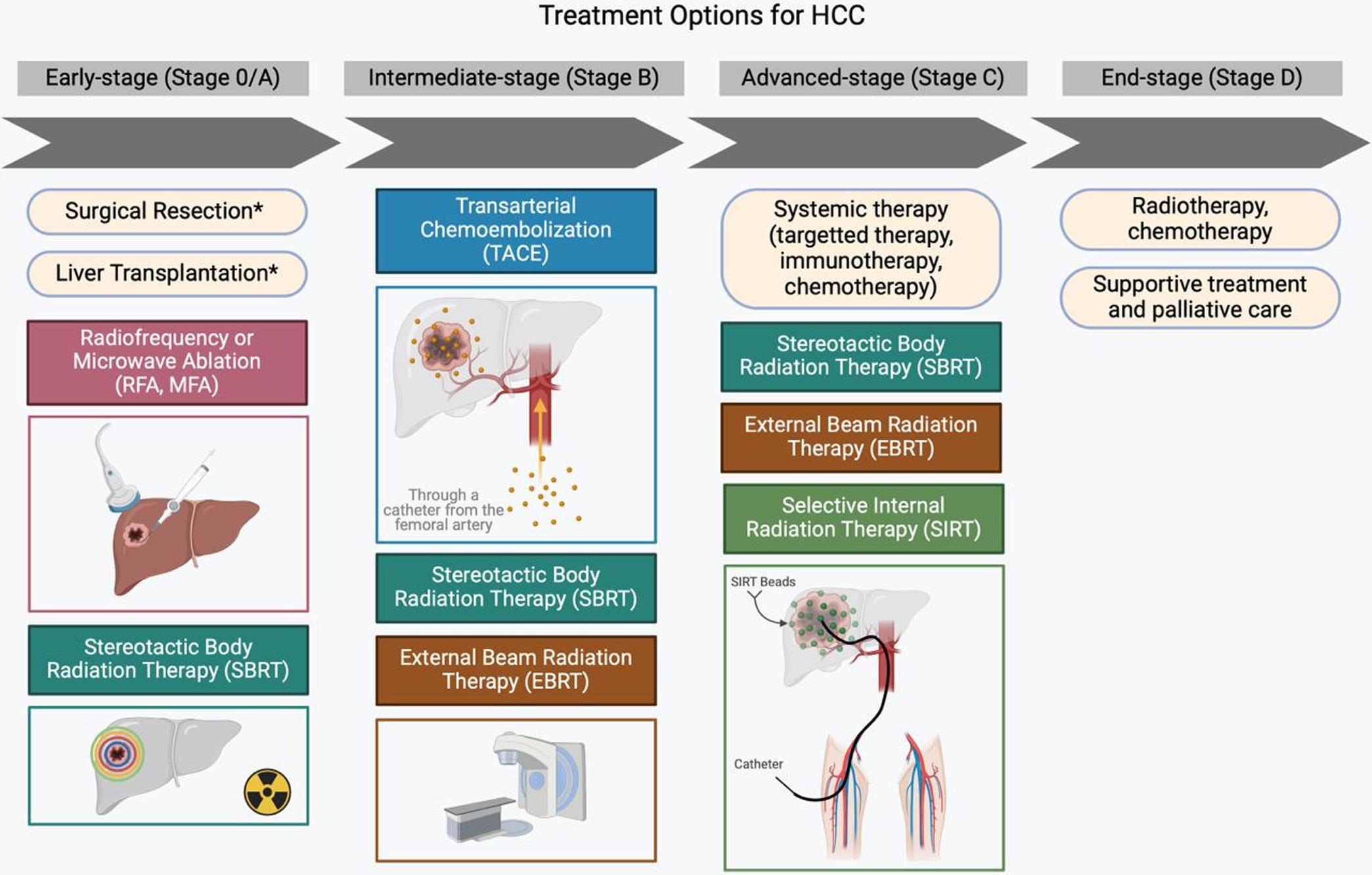 Representation of treatment options for HCC.